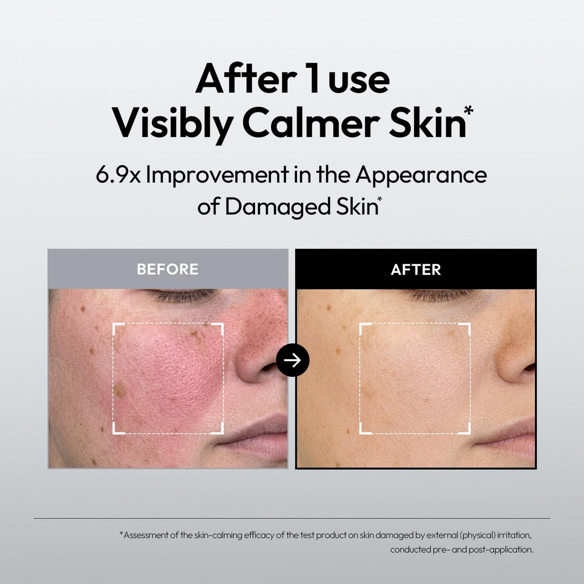 LAYERLAB Barrier Boost Serum Panthenol Niacinamide Face - LAYERLAB Official Imagery - 5