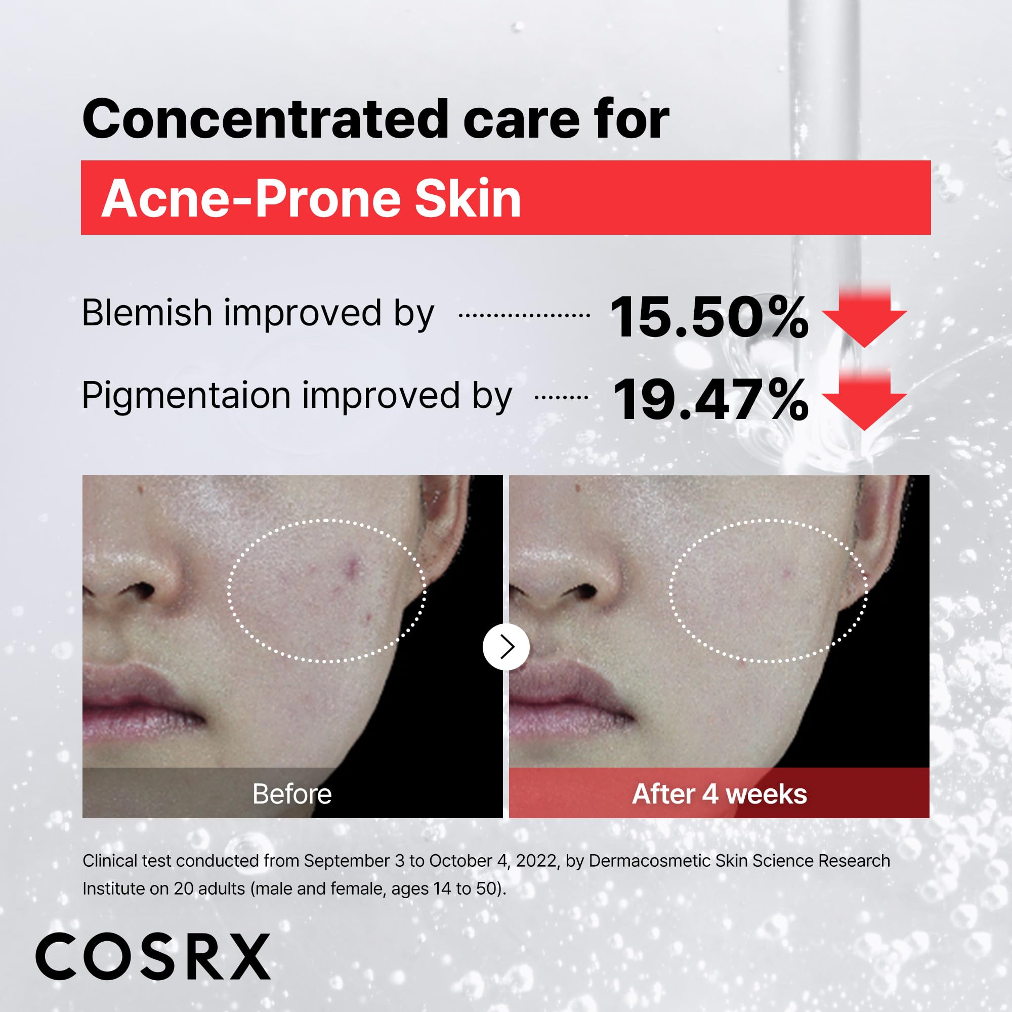 COSRX 15% Niacinamide Face Serum, 0.67 fl oz, Pore Minimizer - COSRX