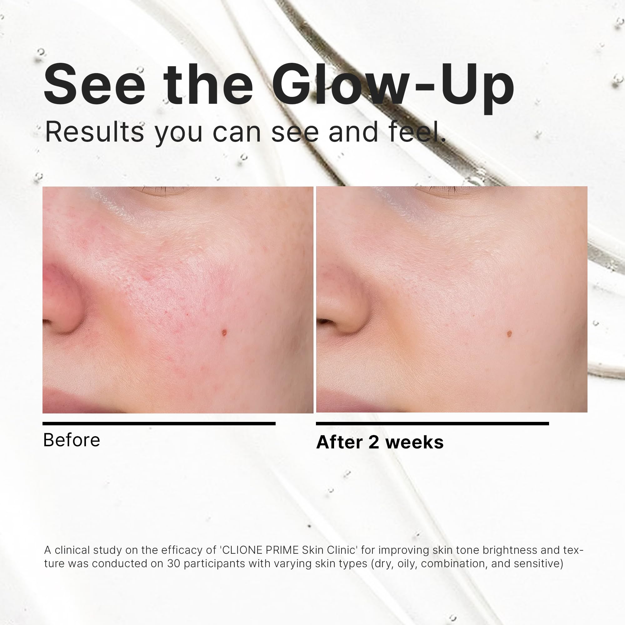 Korean Skin Care Set For Women - CLIONE PRIME