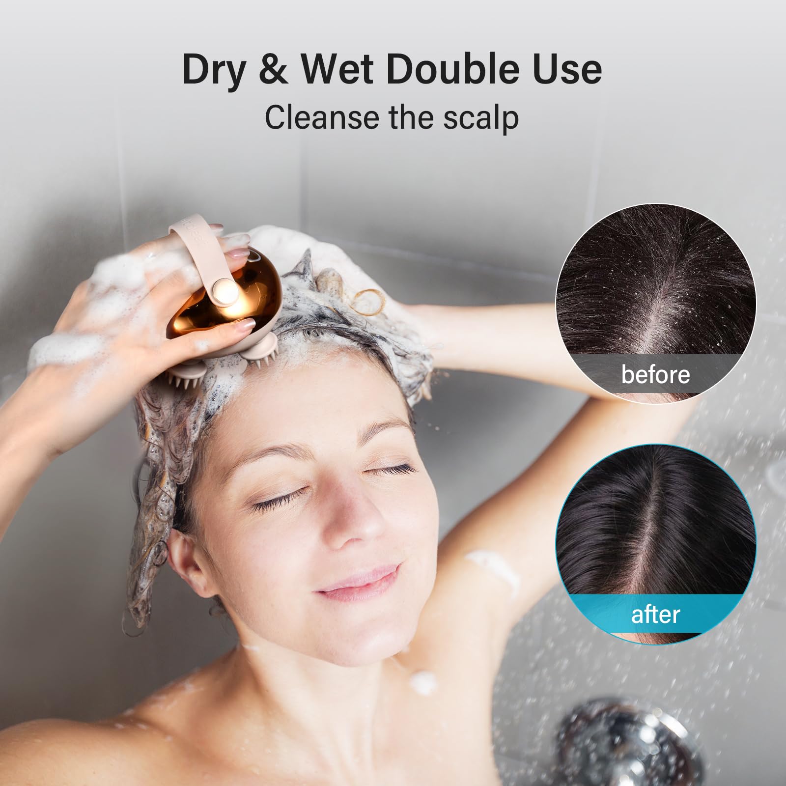 arboleaf Electric Scalp Massager Head Massager Scalp Stress Relax by arboleaf - Angle View 4