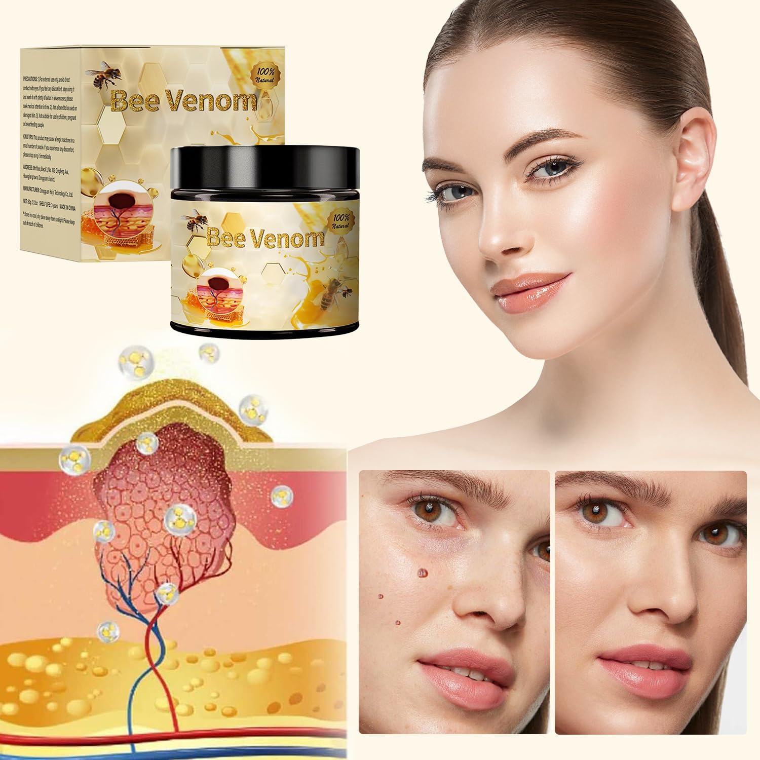 Bee Venom Treatment Cream, 2026 New Professional Bee Venom Repair Cream, For All Body Parts(2 Bottles)
