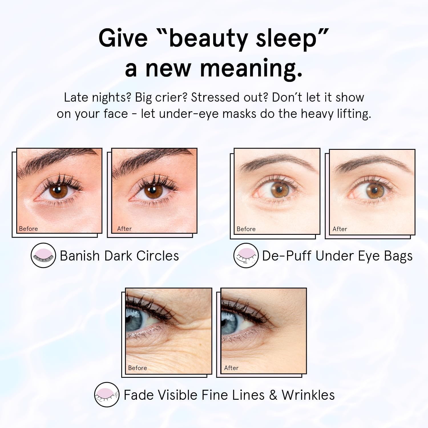 grace & stella Retinol Under Eye Patches for Puffy Eyes - grace & stella Official Product View 5