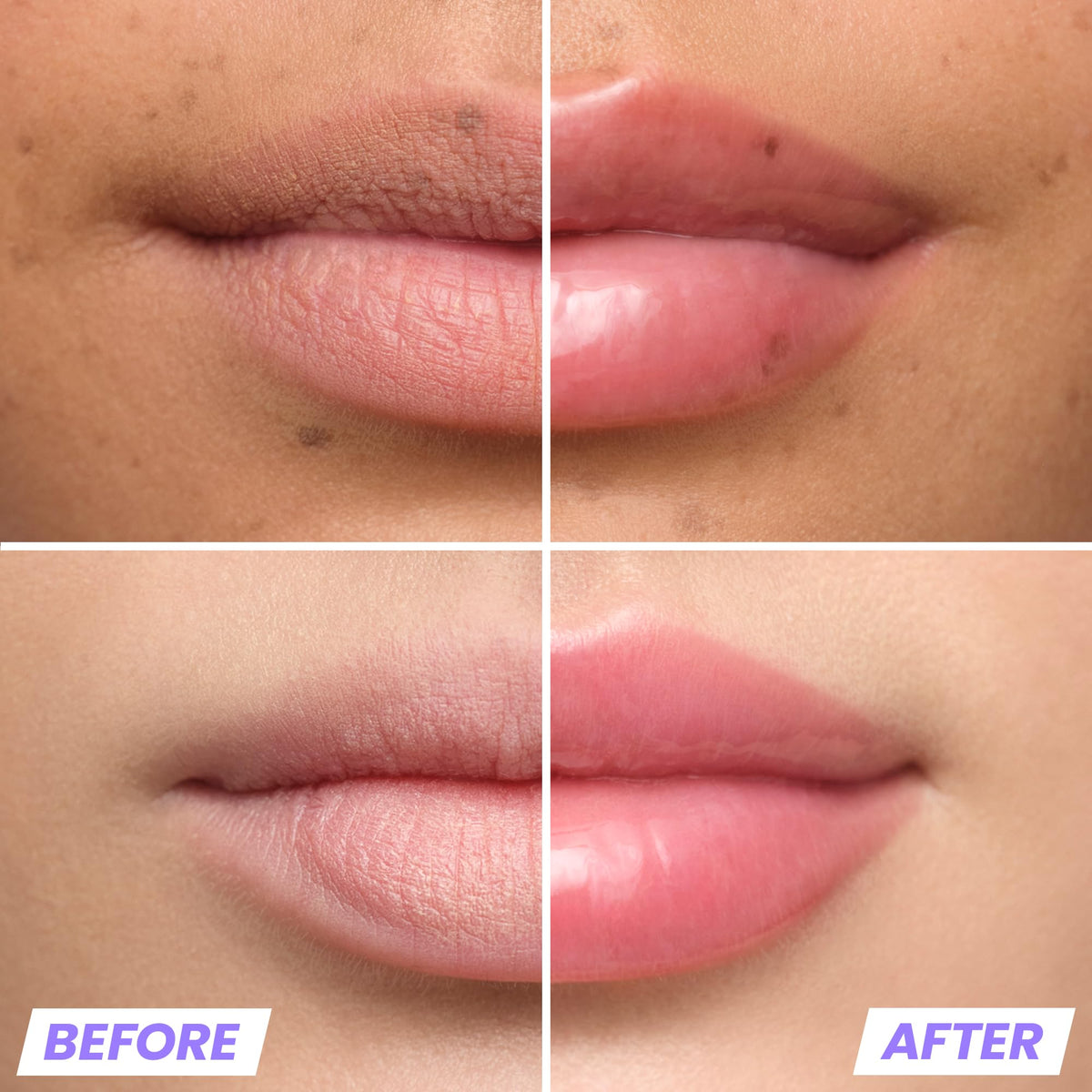 Wonderskin Lip Plumper Gloss - Wonderskin Official Imagery - 3