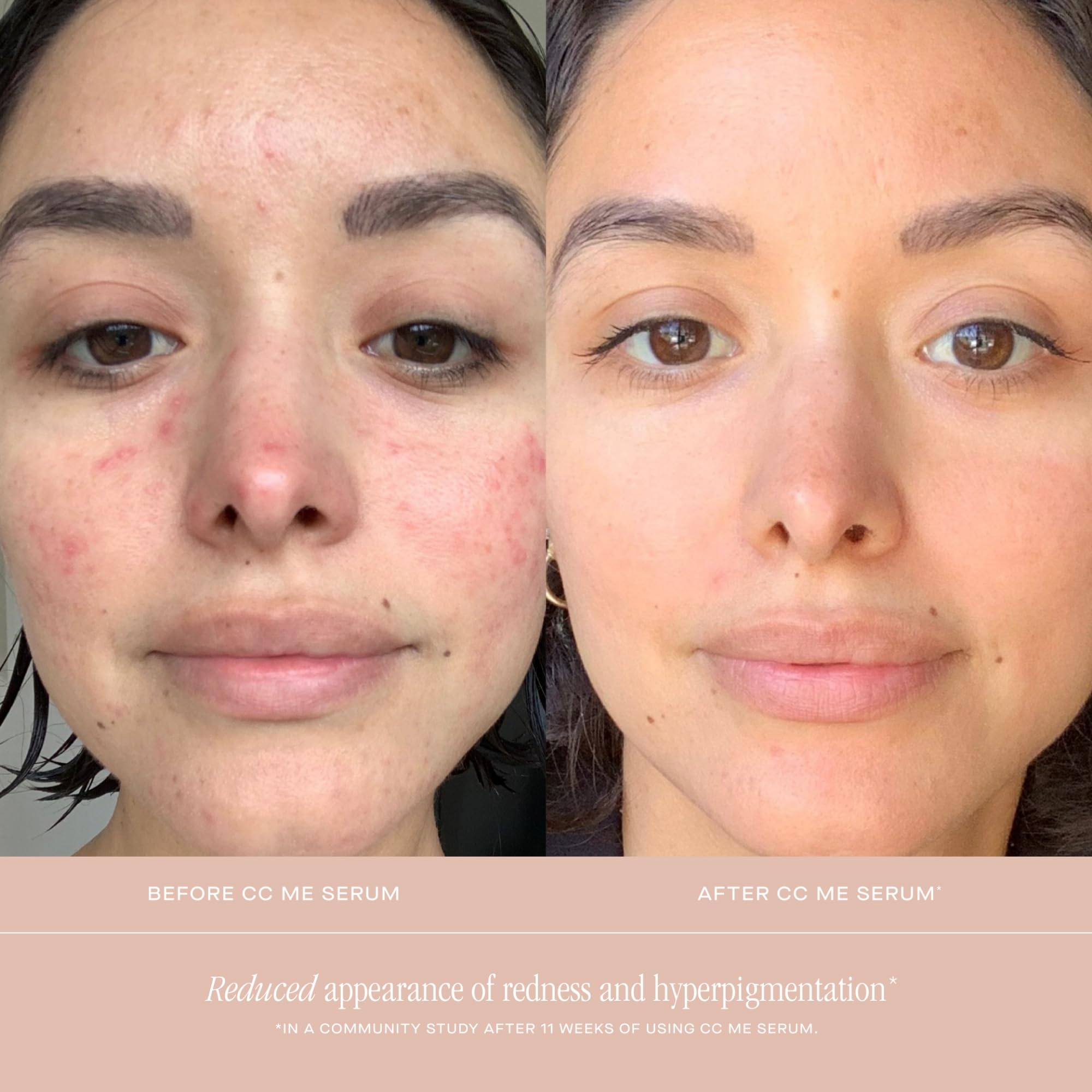 Summer Fridays CC Me Face Serum with Vitamin C Niacinamide - Summer Fridays Official Imagery - 7