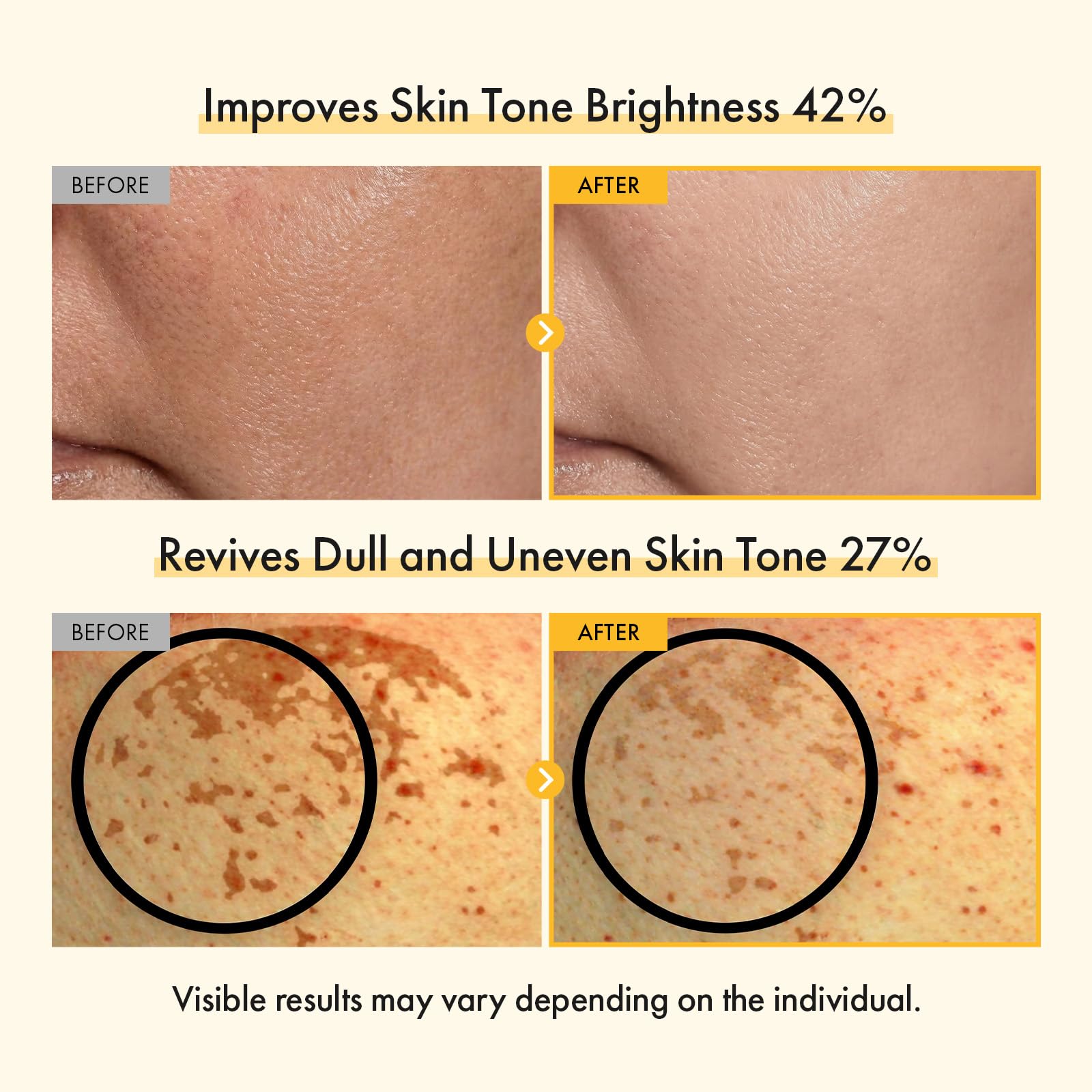 TOSOWOONG Vitamin C Brightening Cream for Even Tone & Dark Spots, Freckles - TOSOWOONG Official Product View 4