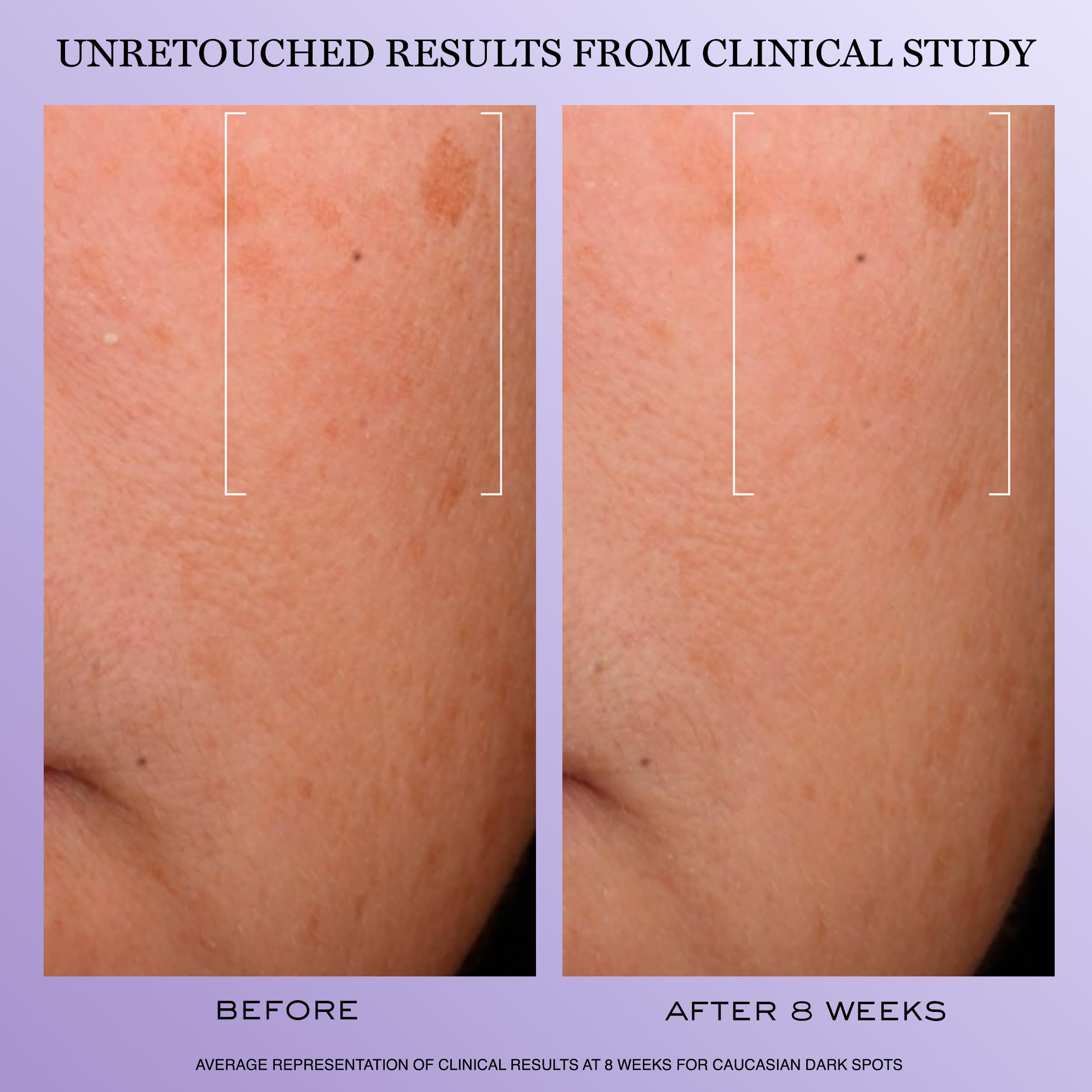 Lanc me R nergie H C F Triple Serum - Premium Selection Official Imagery - 5