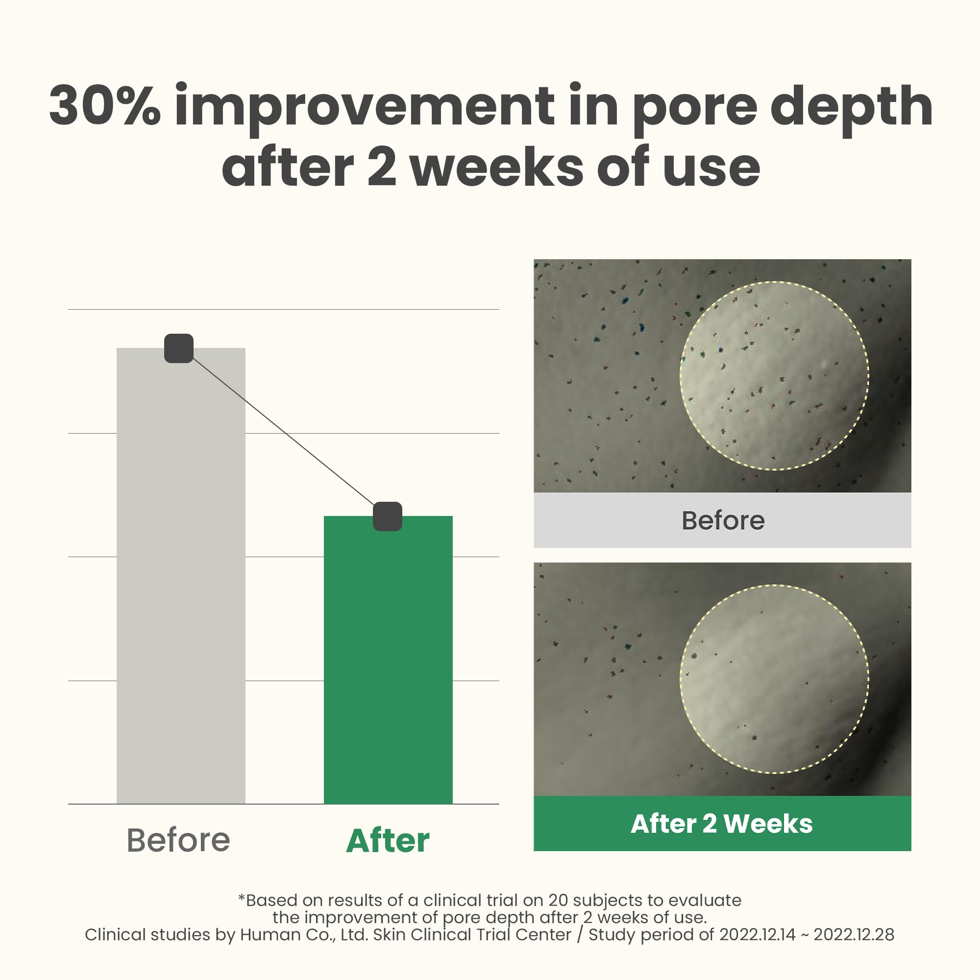 AXIS-Y LHA Peel &amp; Fill Pore Balancing Cream, Korean Daily - AXIS-Y
