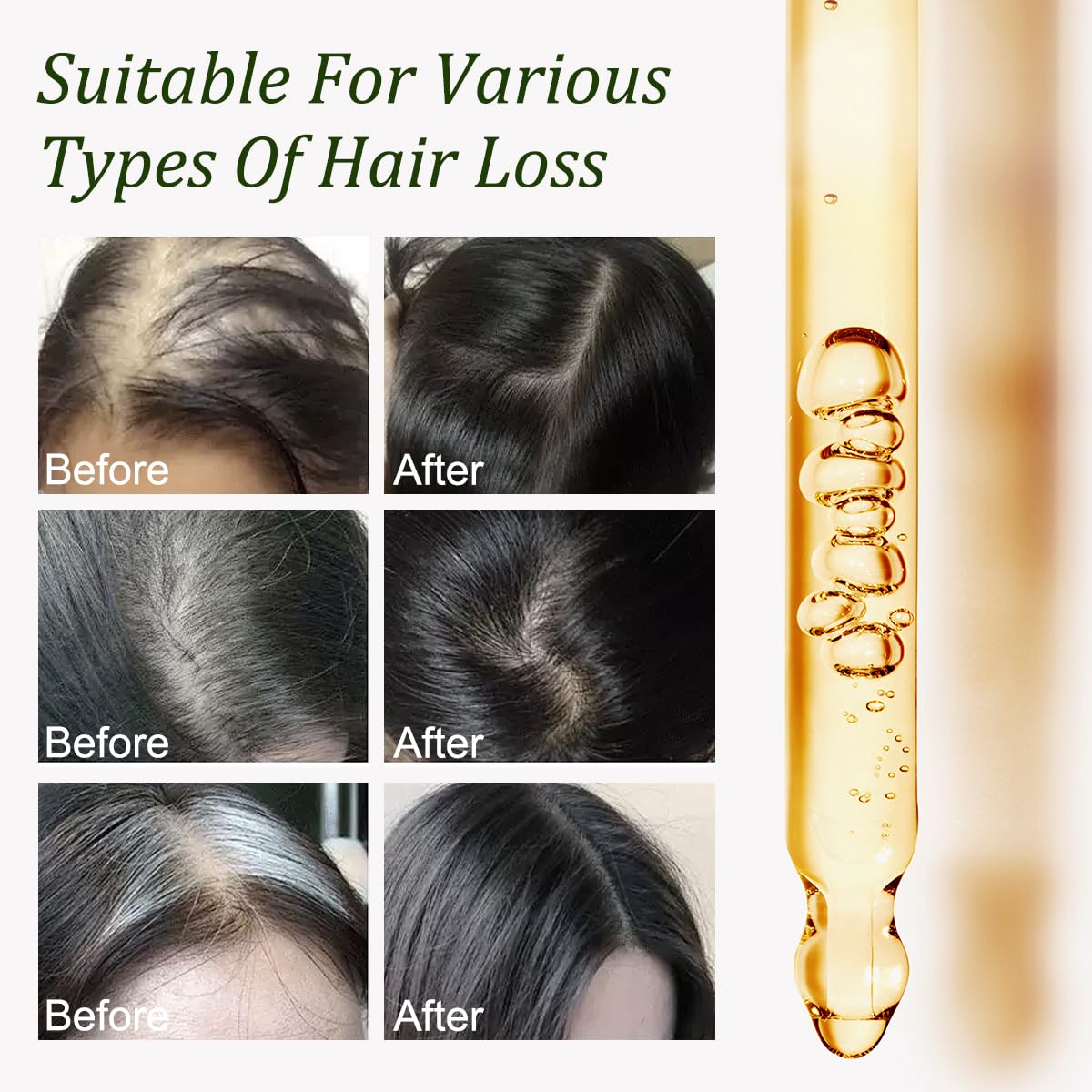 Gypsophila Batana Oil for Hair Growth - 100% Pure Natural Hair Growth Oil & No - Gypsophila Official Product View 5