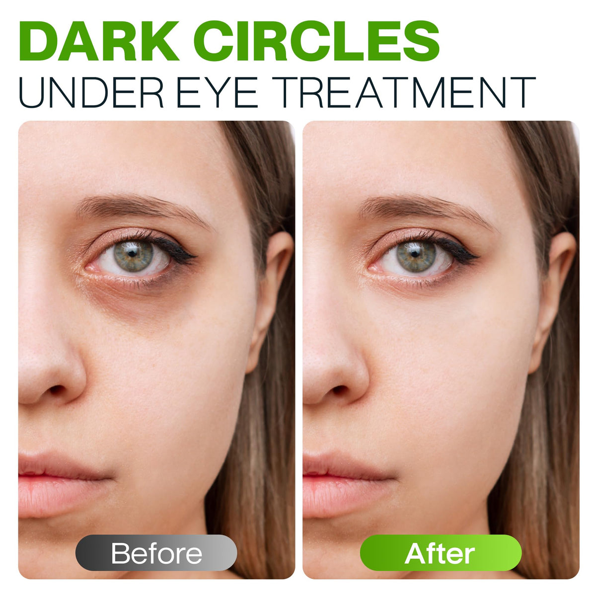 Peptide Eye Cream Anti Aging Hydrating Under Eye Cream For - AloeMoist Official Imagery - 5