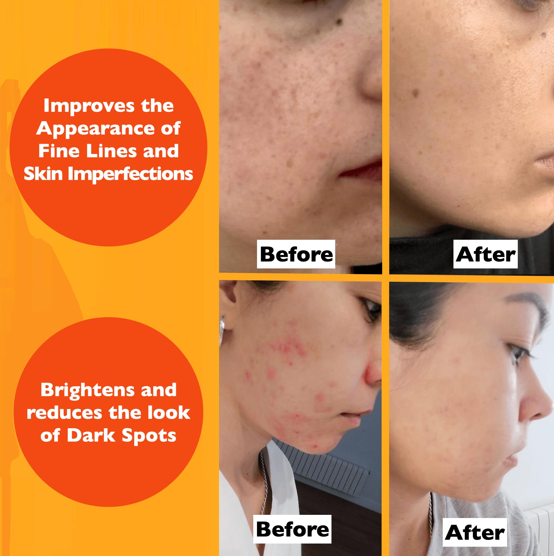 Florence Vitamin C Serum For Face – Anti Aging Face Serum with Vitamin C, - Florence Official Product View 6