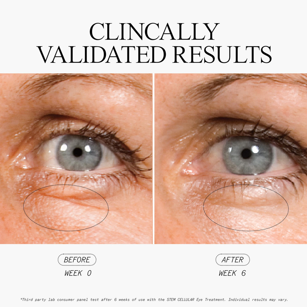 Juice Beauty Stem Cellular Anti Wrinkle Eye Treatment - Juice Beauty Official Imagery - 5