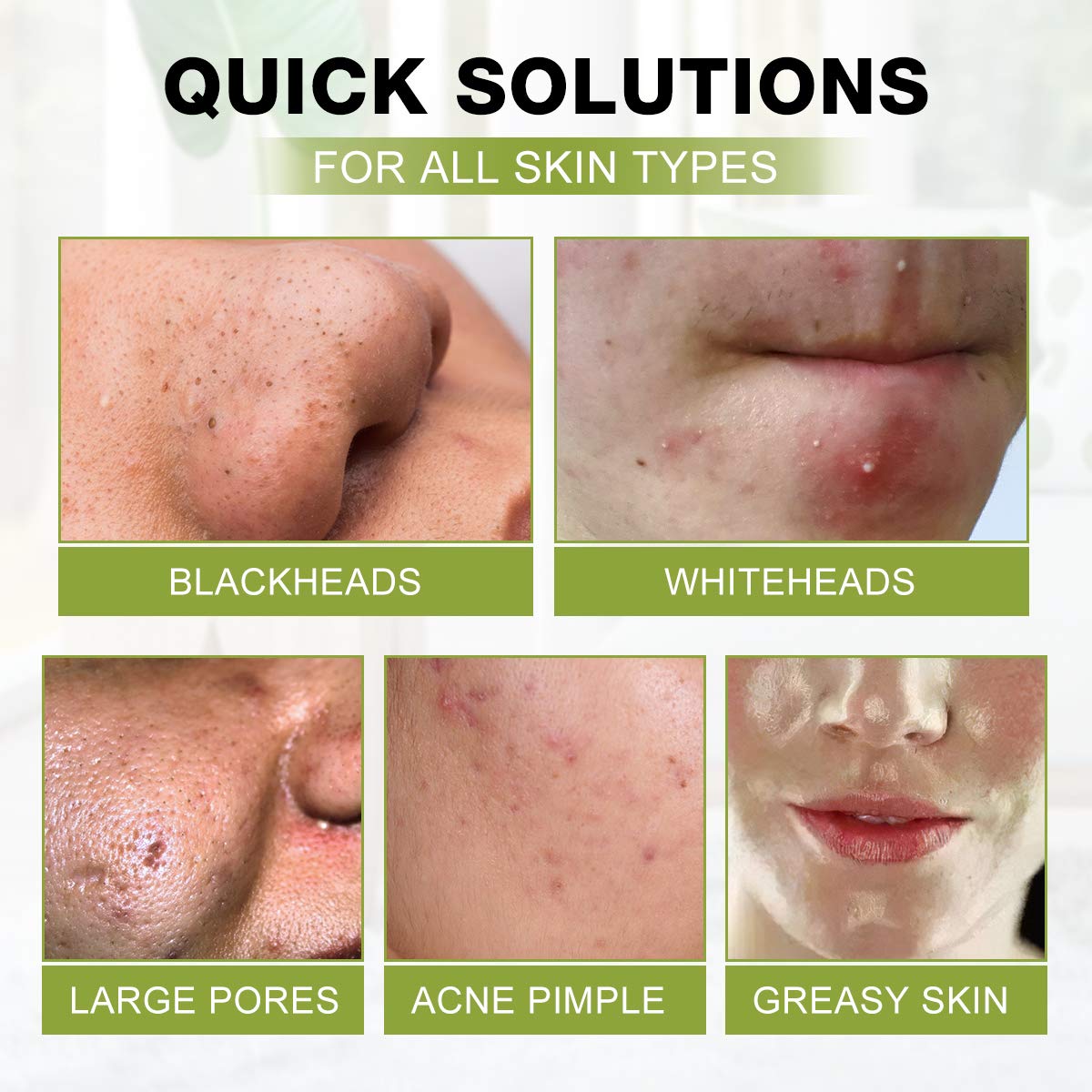 Blackhead Peel Off Face Mask, SHVYOG 3-in-1 Blackhead Remover - SHVYOG