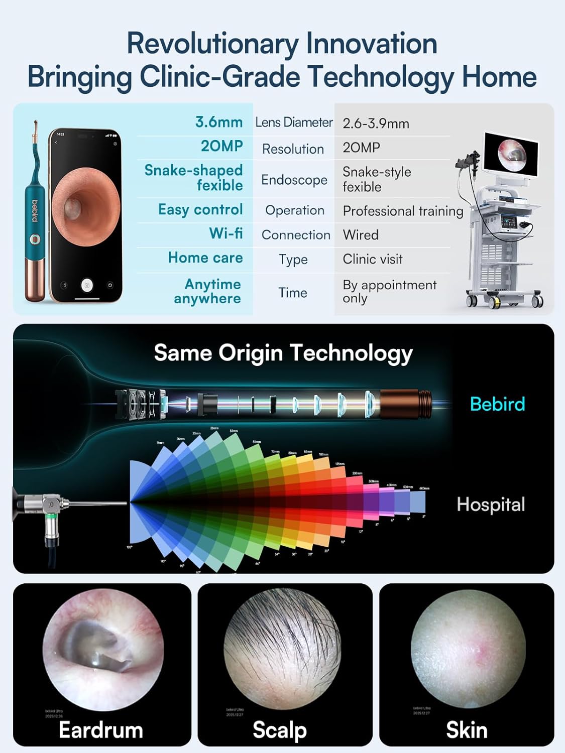 BEBIRD Ultra Ear Wax Removal Kit with 2K HD camera, visual ear cleaner and earwax removal tool in a sleek design