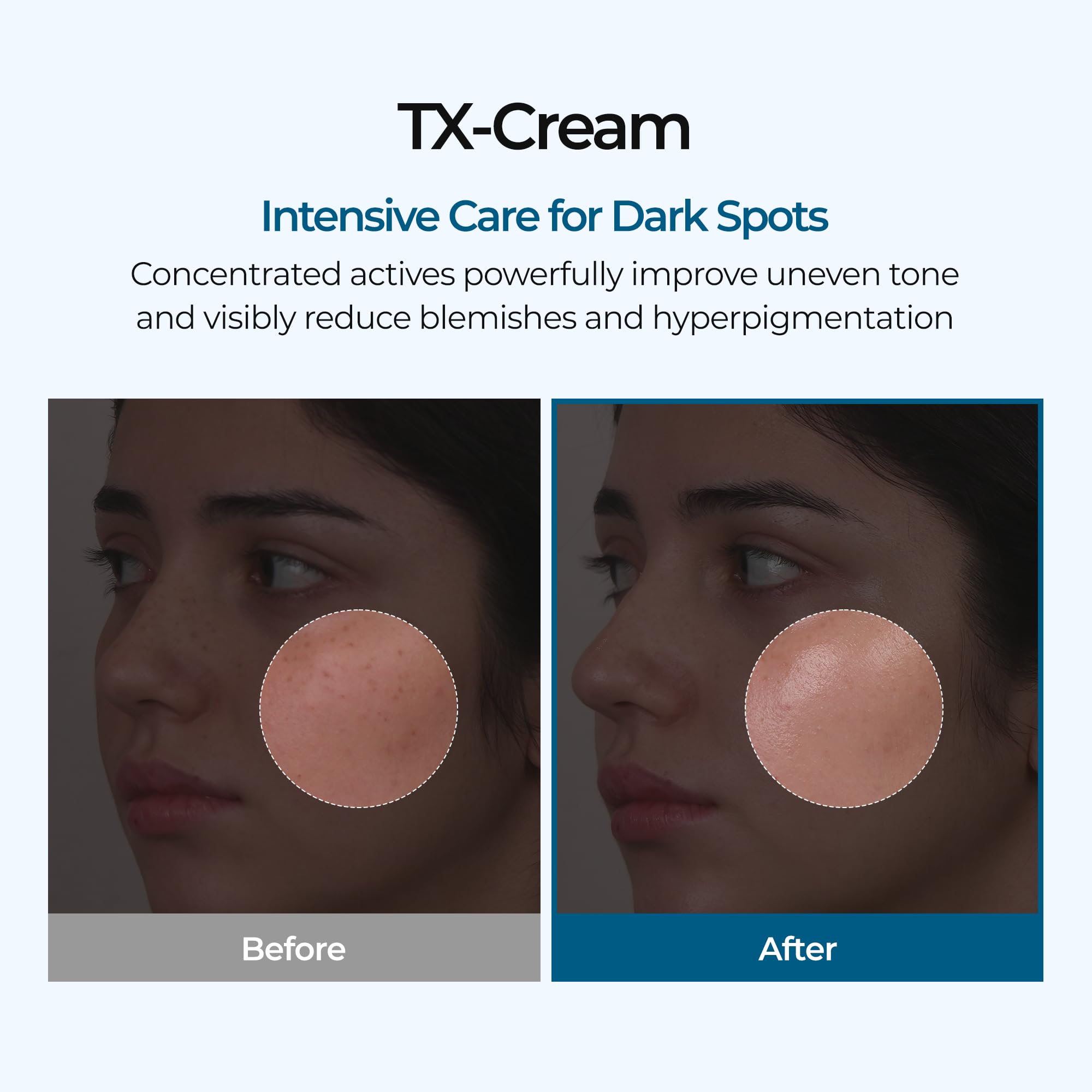 DR.Melaxin TX Tranexamic Acid CREAM - Skin freckle Cream & Blemishes & Anti - Dr.Melaxin Official Product View 3