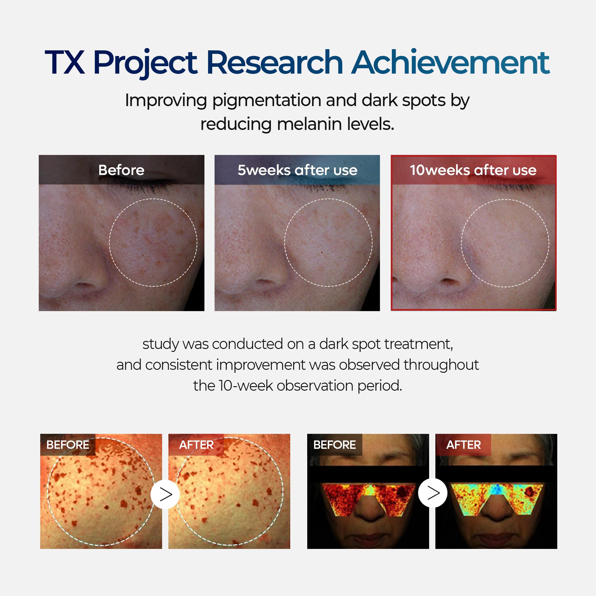DR.Melaxin TX Tranexamic Acid CREAM - Skin freckle Cream & Blemishes & Anti - Dr.Melaxin Official Product View 7