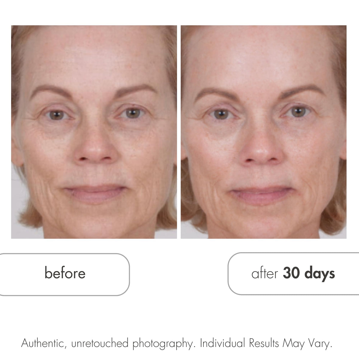 Serious Skincare Glycolic Acid Cleanser Deep Pore Purifying - Serious Skincare Official Imagery - 6