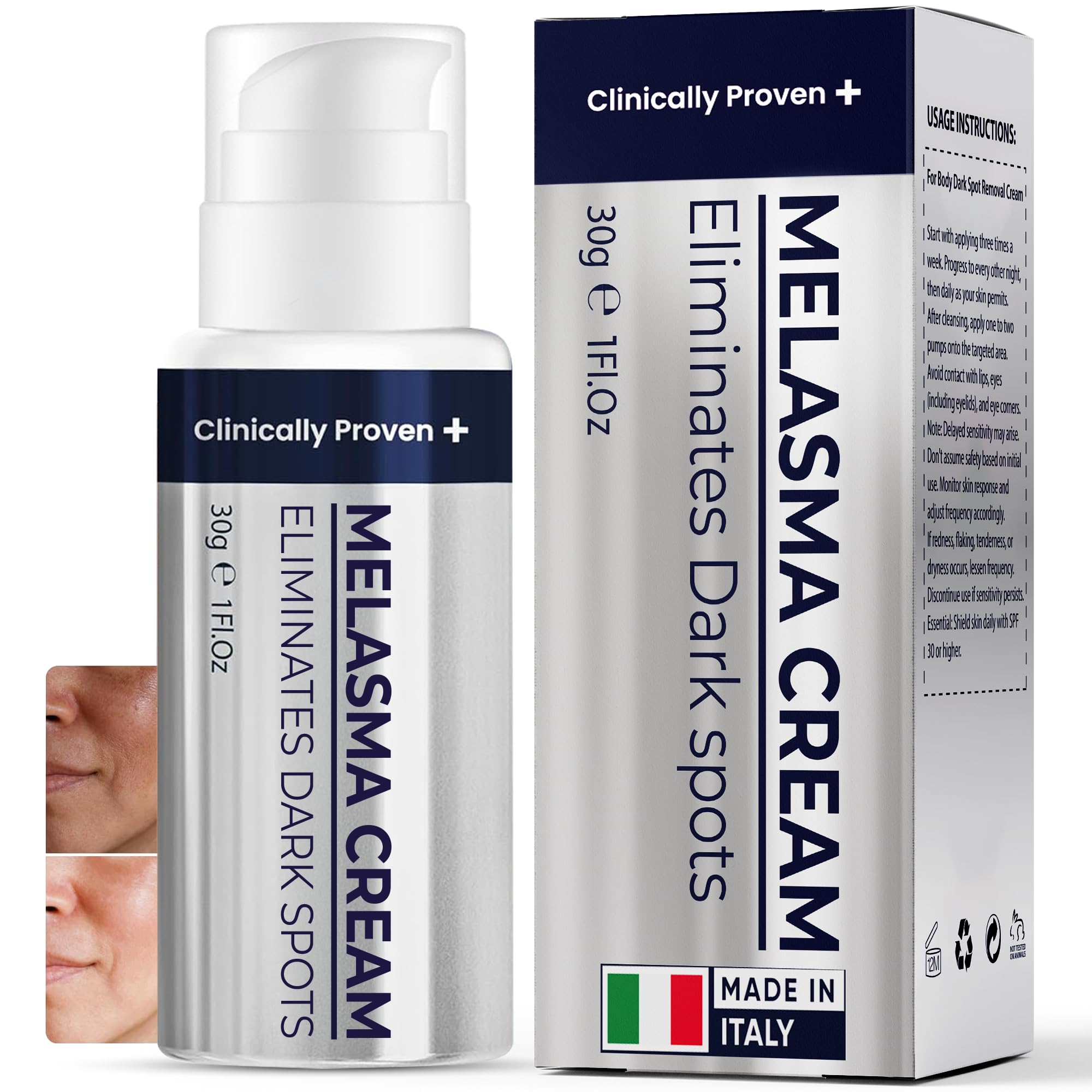 Melasma Treatment for Face - Pharmlitalia
