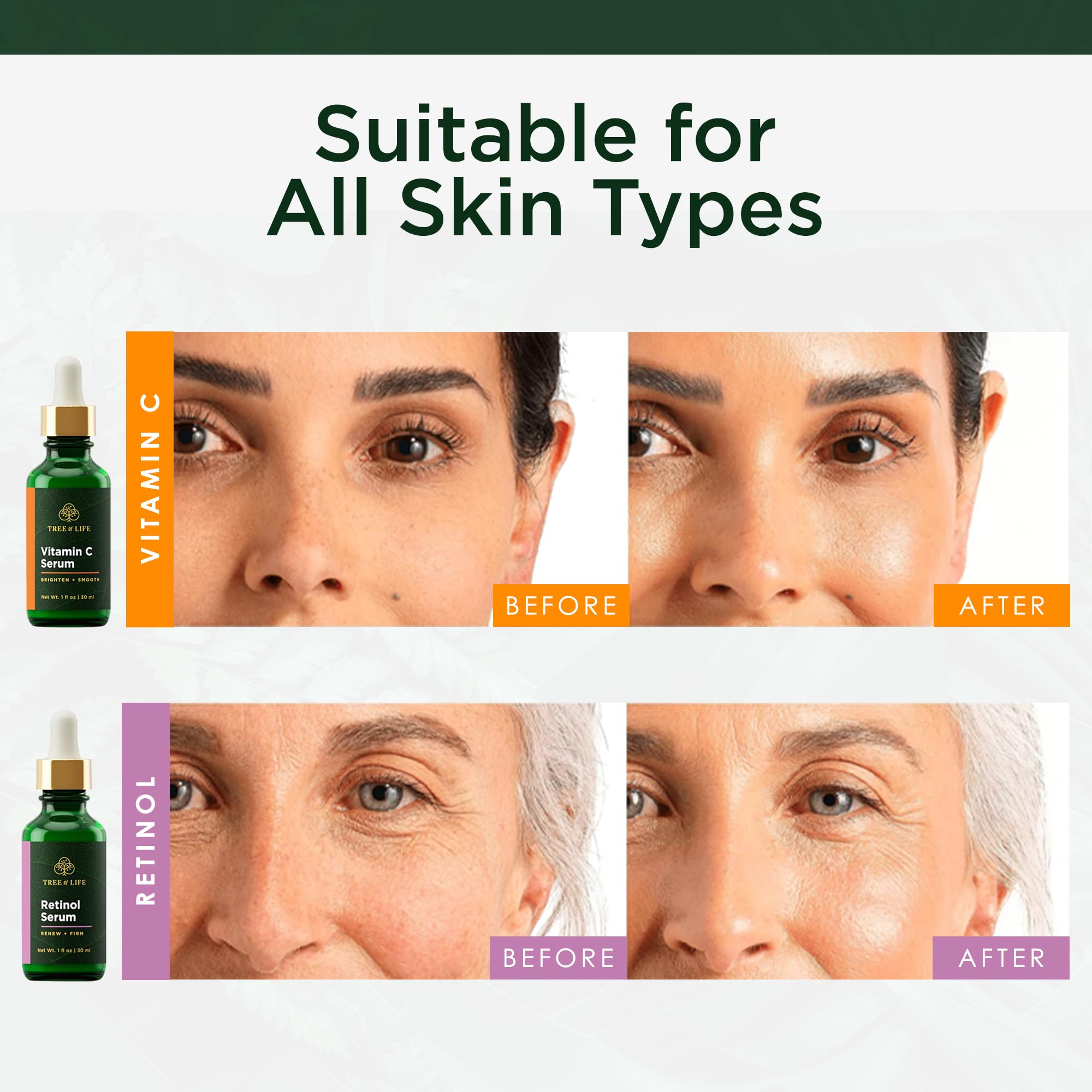Tree of Life Face Serum Skin Care Set Vitamin C Retinol - Tree of Life Official Imagery - 4