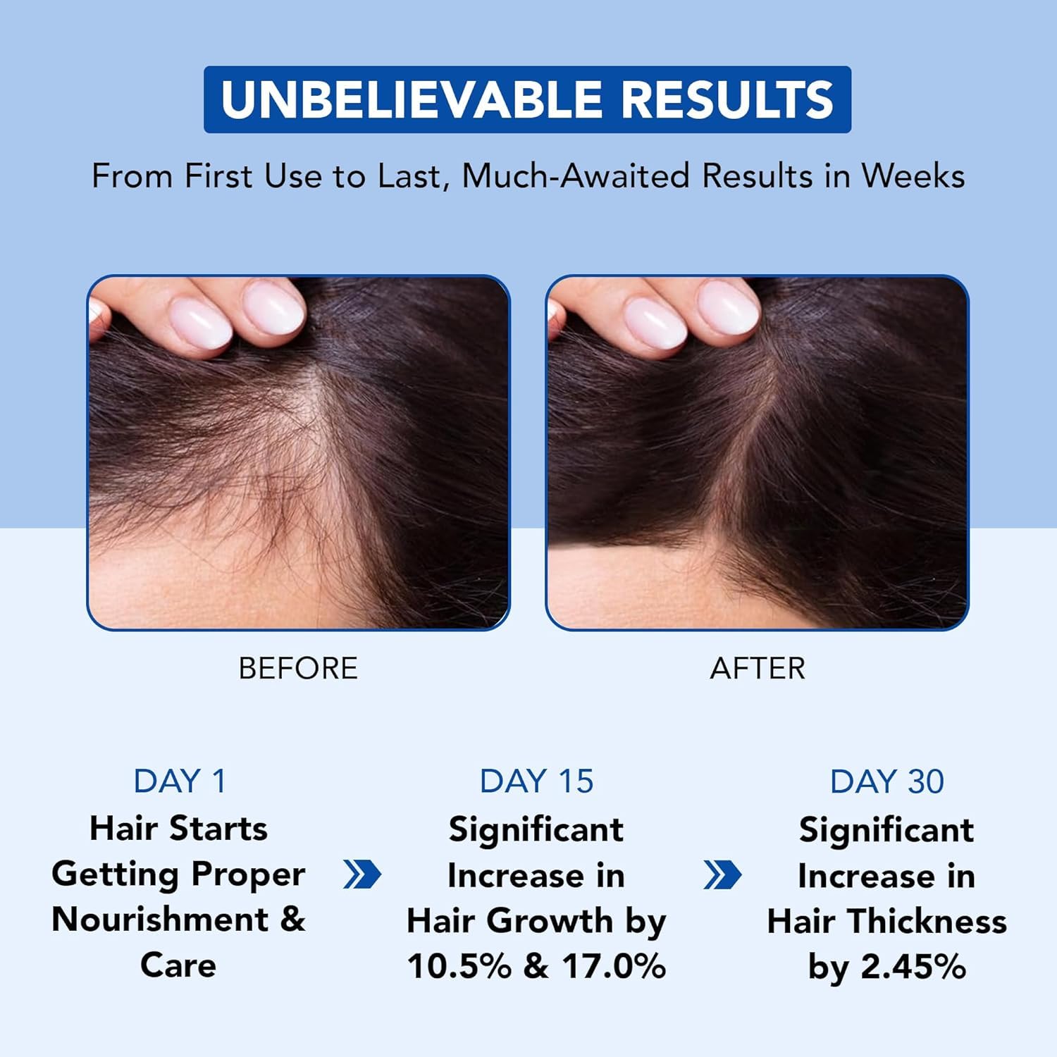 Botanic Hearth Rosemary Oil for Hair Growth - 6.7 Fl oz - Botanic Hearth Official Product View 5