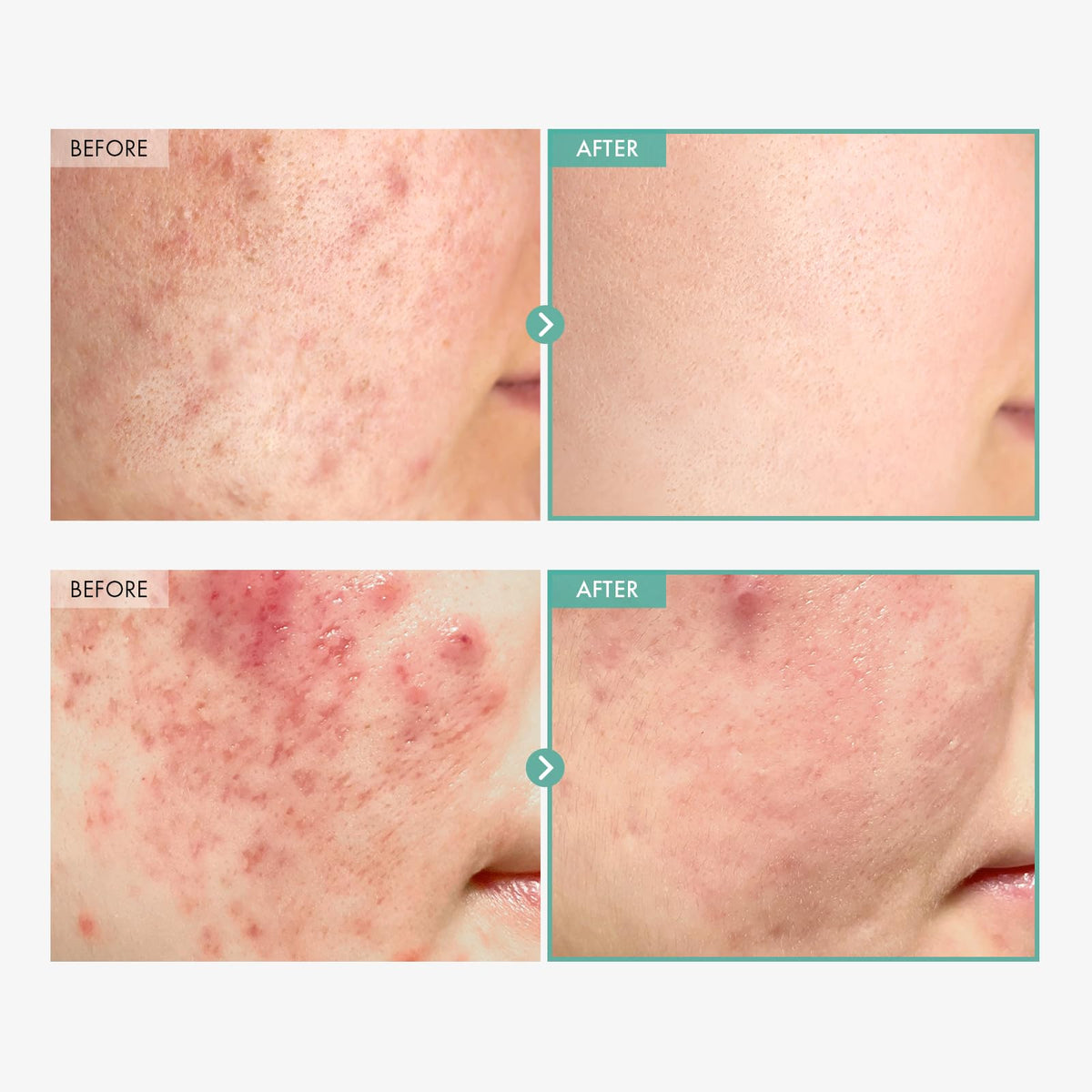 TOSOWOONG Dexpanthenol 17 Cream B5 for Barrier Hydrating - TOSOWOONG Official Imagery - 4