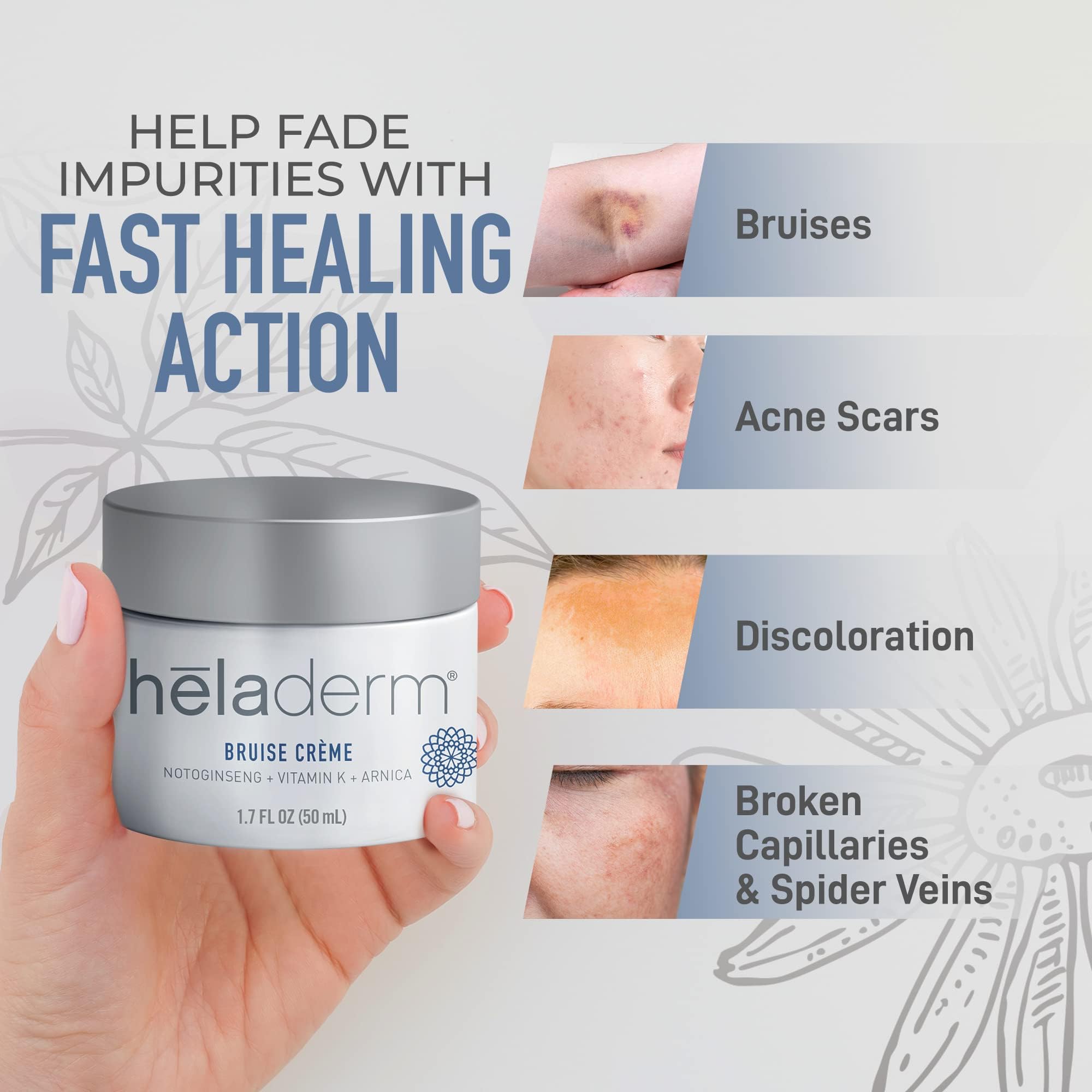 Heladerm Arnica Oil Bruise Cream Extra Strength (Fast Healing) - Bruise Cream for Seniors - Targeted Care to Help Restore Skin’s Vitality, Arnica for Bruising and Swelling - 50mL