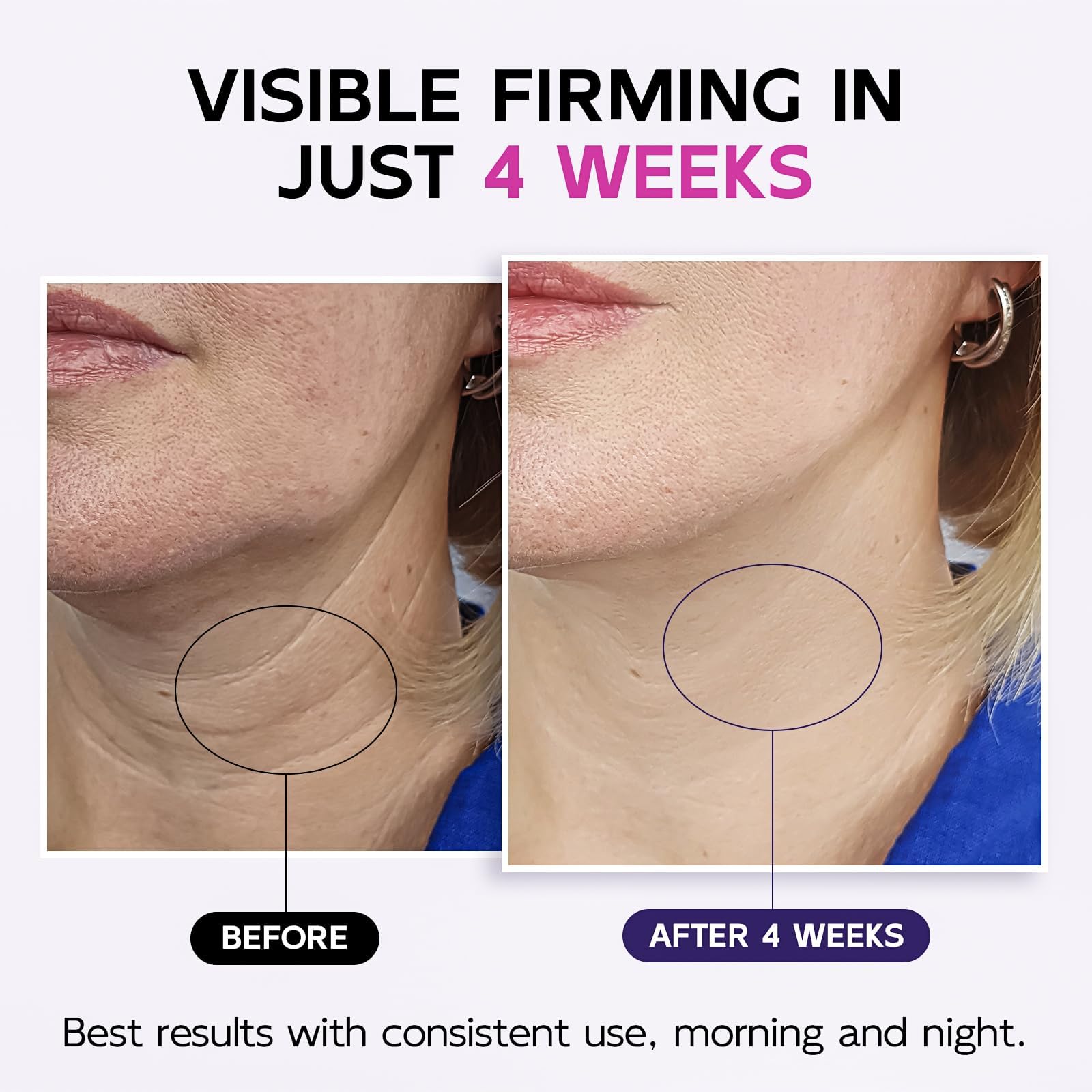 Neck Firming Cream with Retinol Tightening Lifting Gua Sha - GOOSURE Official Imagery - 4