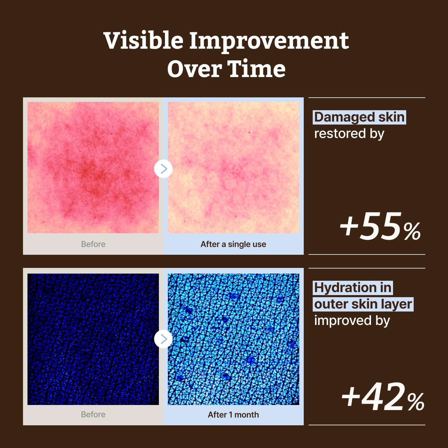 Dr.Reju-All Dr.Reju - All Advanced LC Ceramide Barrier Cream - Dr.Reju-All Official Product View 5