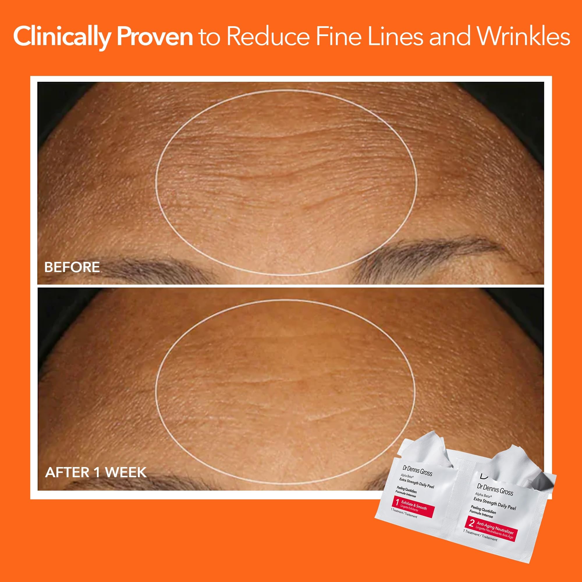 Dr Dennis Gross Alpha Beta Extra Strength Exfoliating Daily Peel - Dr Dennis Gross