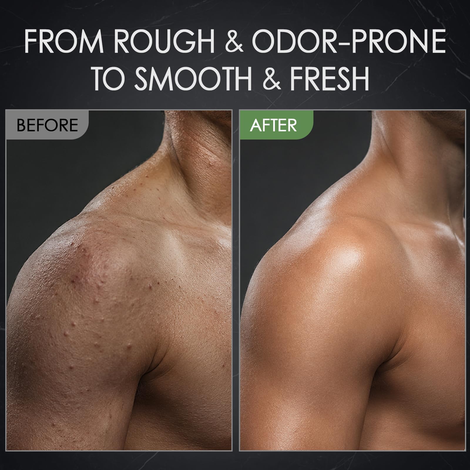 MOSRROU Men's Body Scrub Tea Tree Oil Exfoliating Body Wash Body Scrub - MOSRROU Official Product View 7