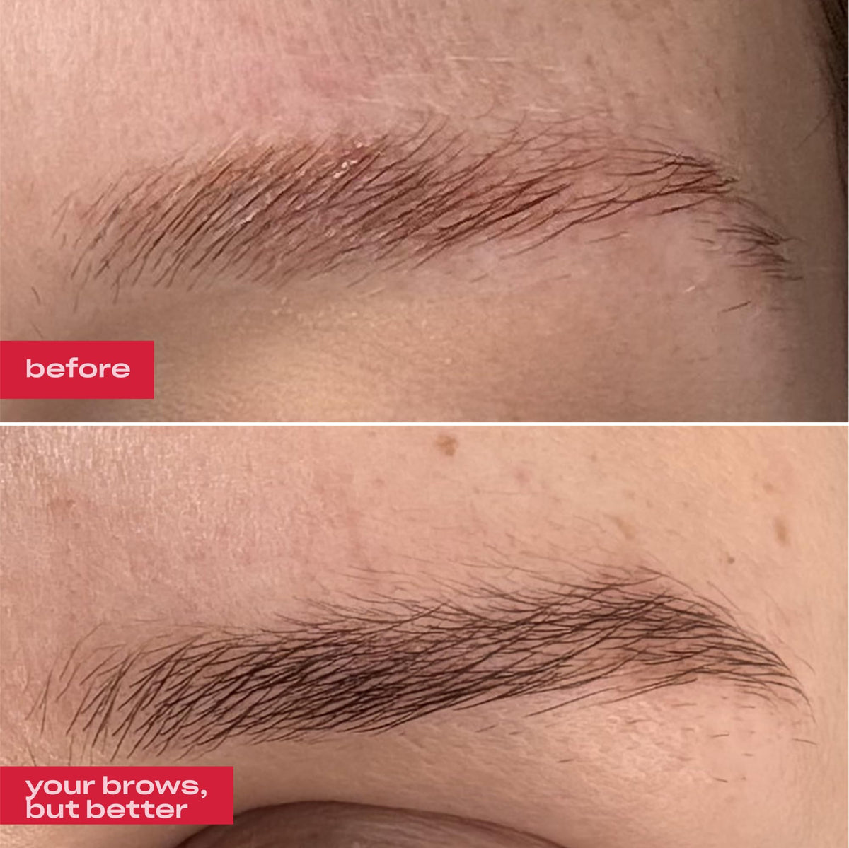 GR A Eyebrow Enhancing Serum Grow thicker and Healthier - gróa Official Imagery - 3