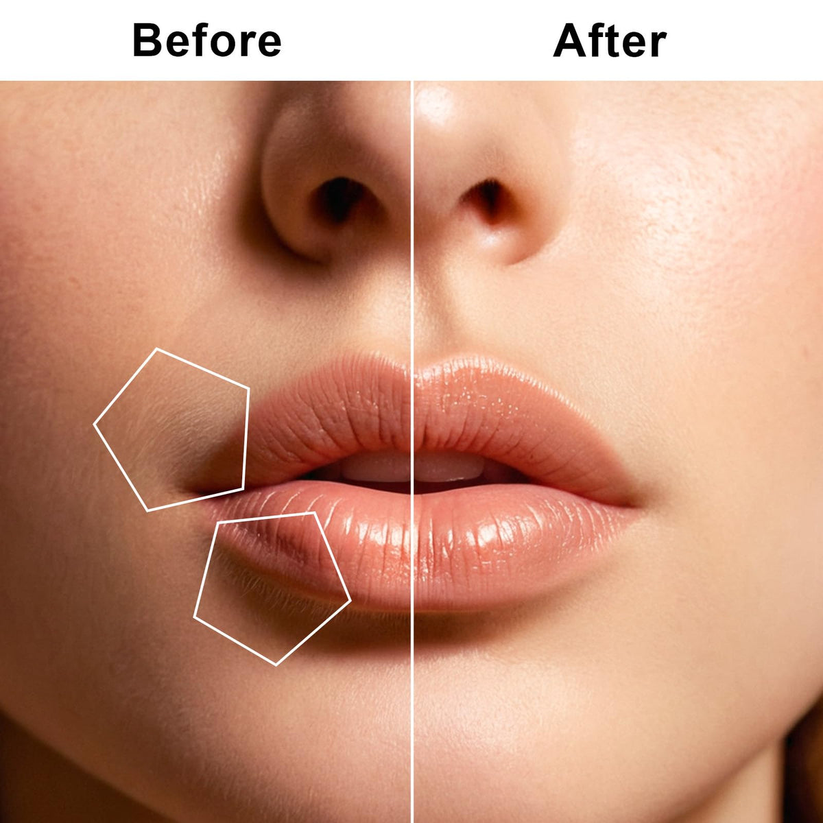 Facial Hair Removal for Women USB Rechargeable 3 Replacement - tuokiy Official Imagery - 4