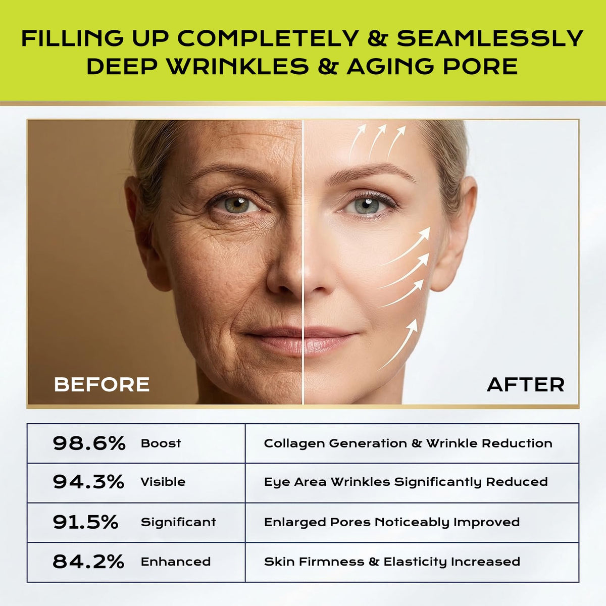 Vita A Retinol Anti Wrinkle Cream Tightening Pore Minimizer - Manoai Official Imagery - 5