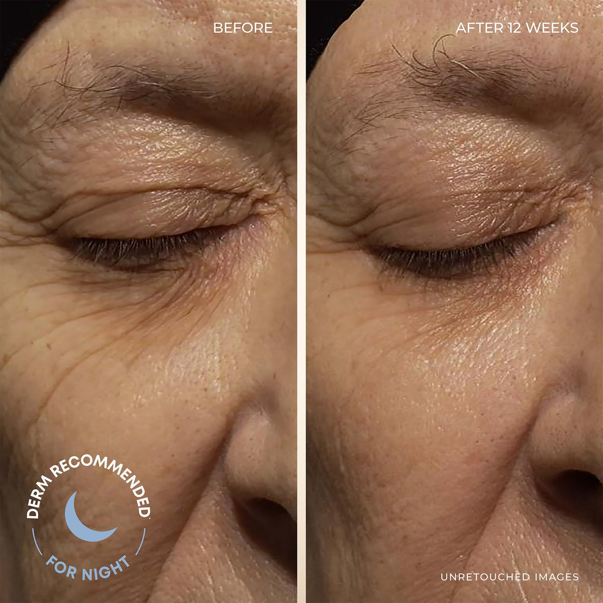 RoC Retinol Correxion Deep Wrinkle Facial Moisturizer Skin - RoC Official Imagery - 4