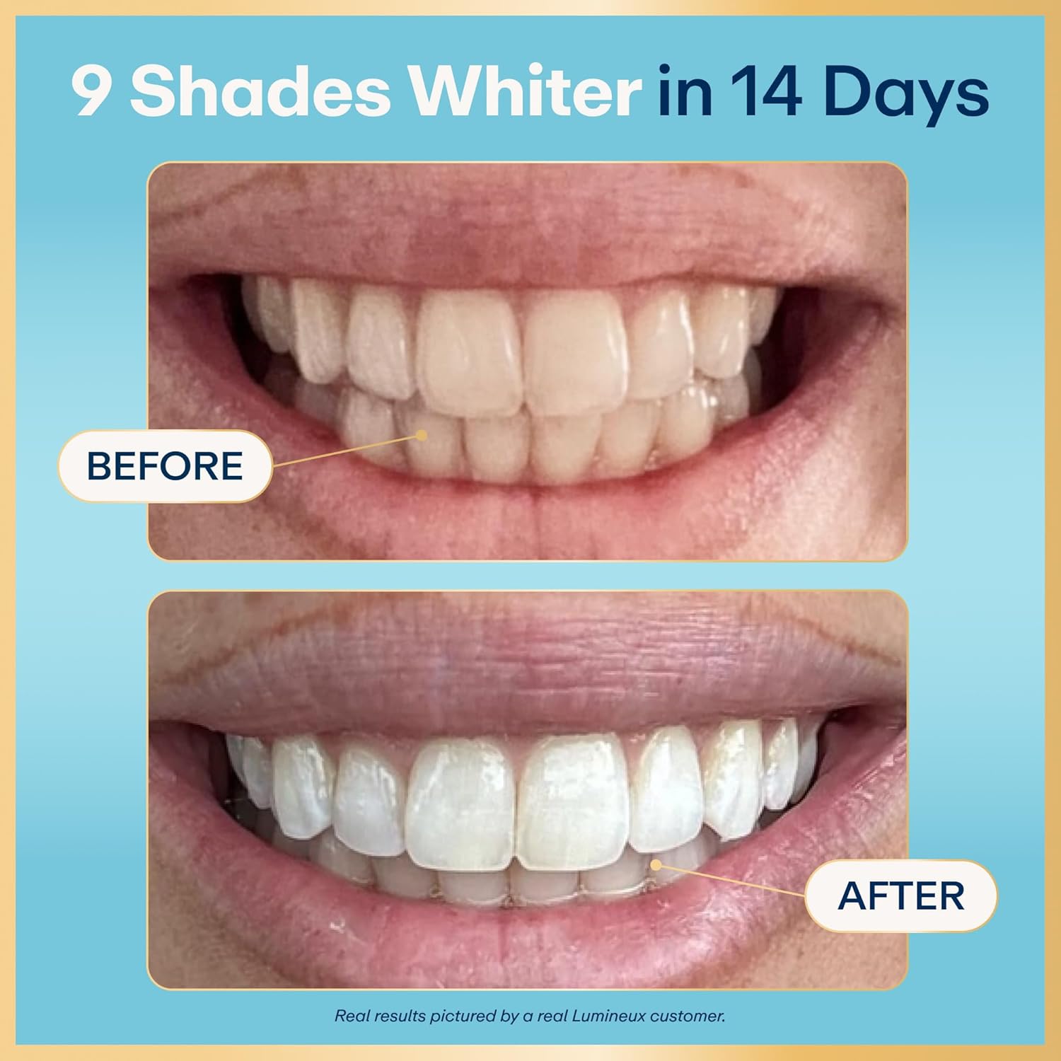 Lumineux teeth whitening strips box showing 21 treatments, peroxide-free, designed for at-home teeth whitening.