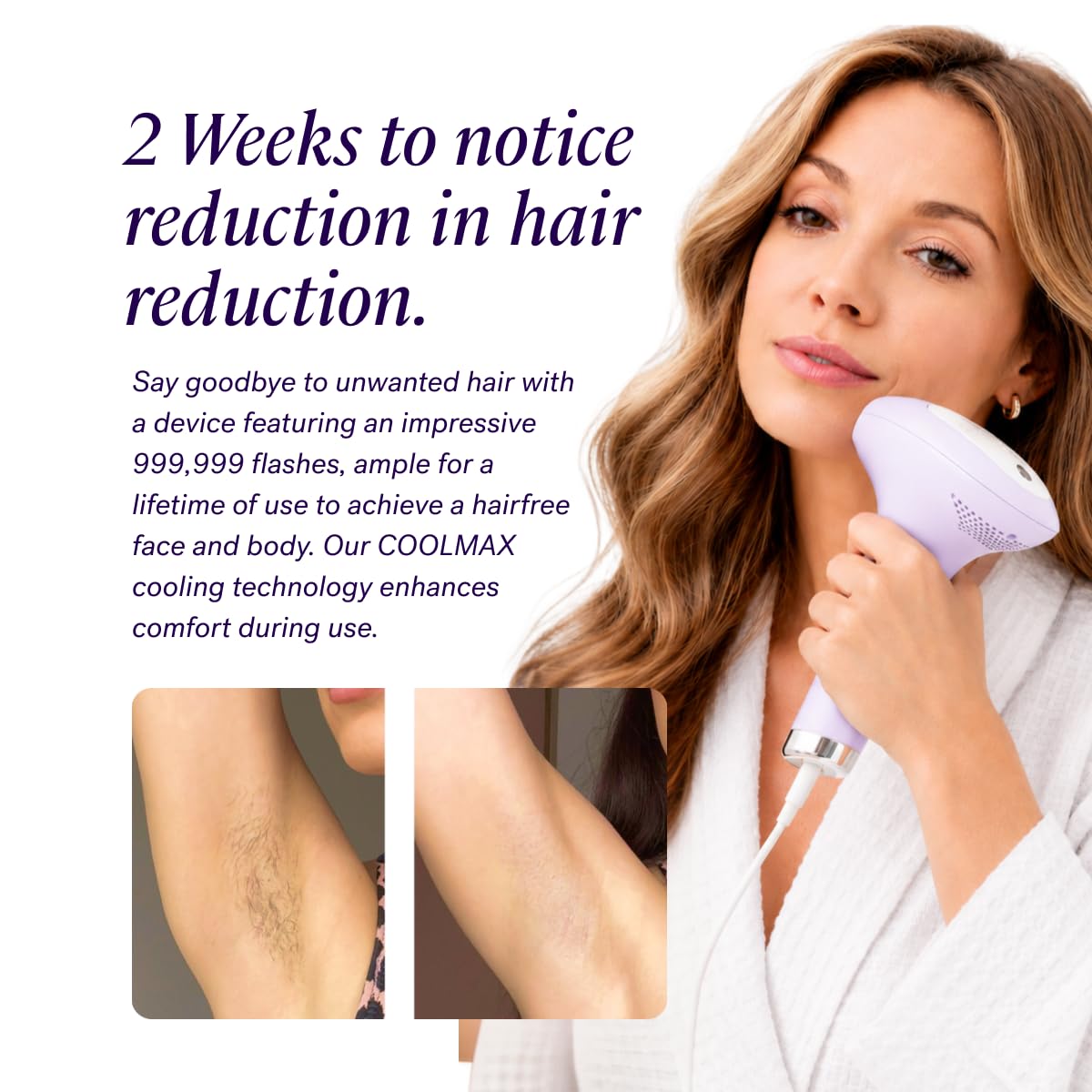 Michael Todd Beauty LUMOS Laser IPL Hair Removal Device for - MICHAEL TODD Official Imagery - 5