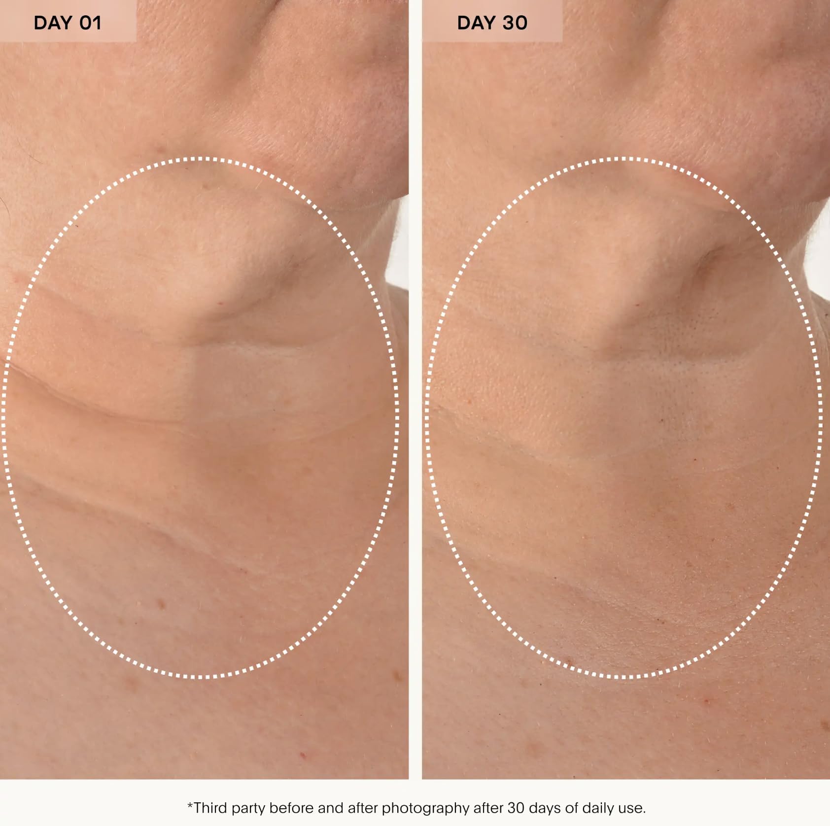 U Beauty The Sculpt Neck and Decollete Concentrate - U Beauty