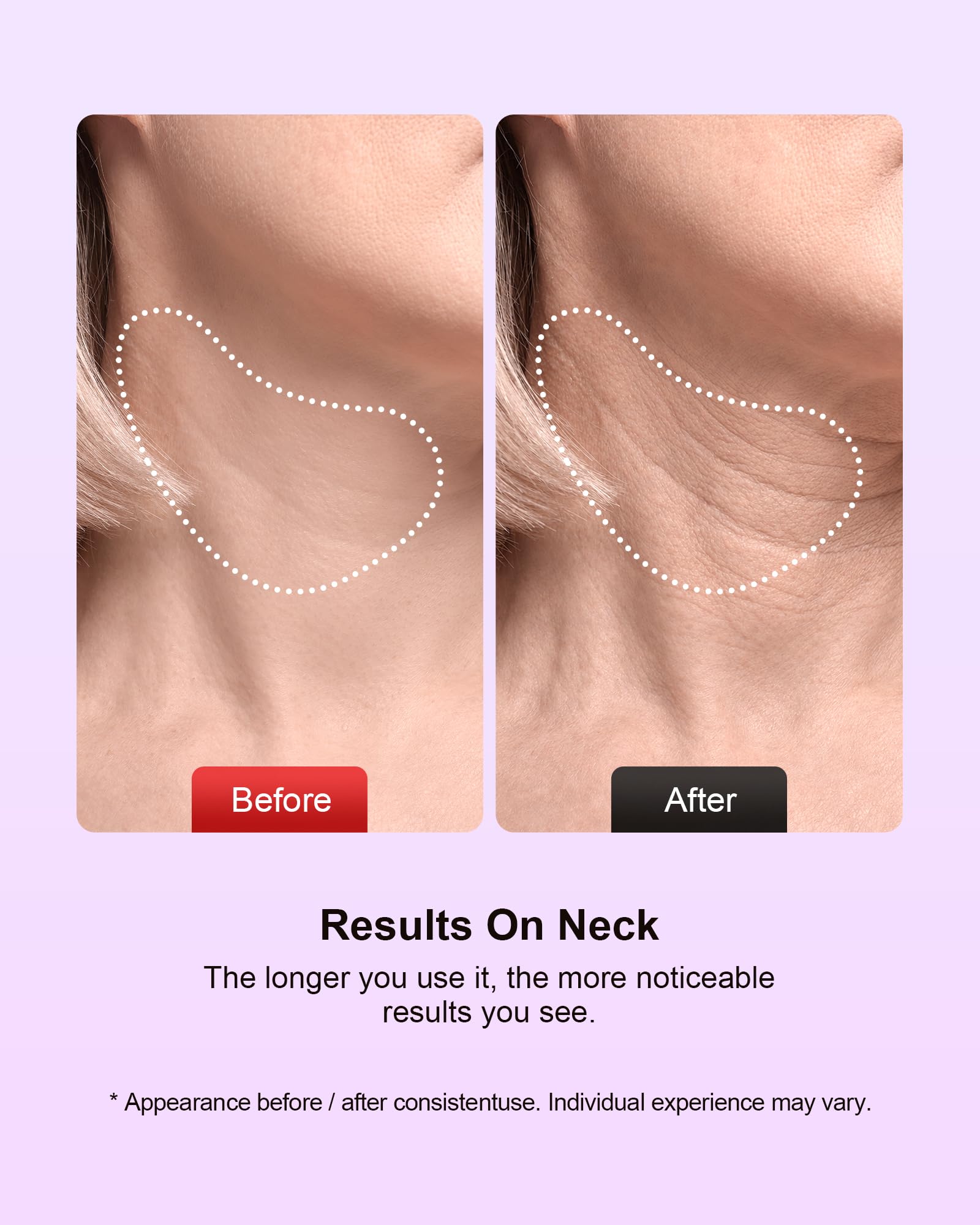Facial Massager 7 Colors Red Light Therapy for Face and Neck - pedete Official Imagery - 8
