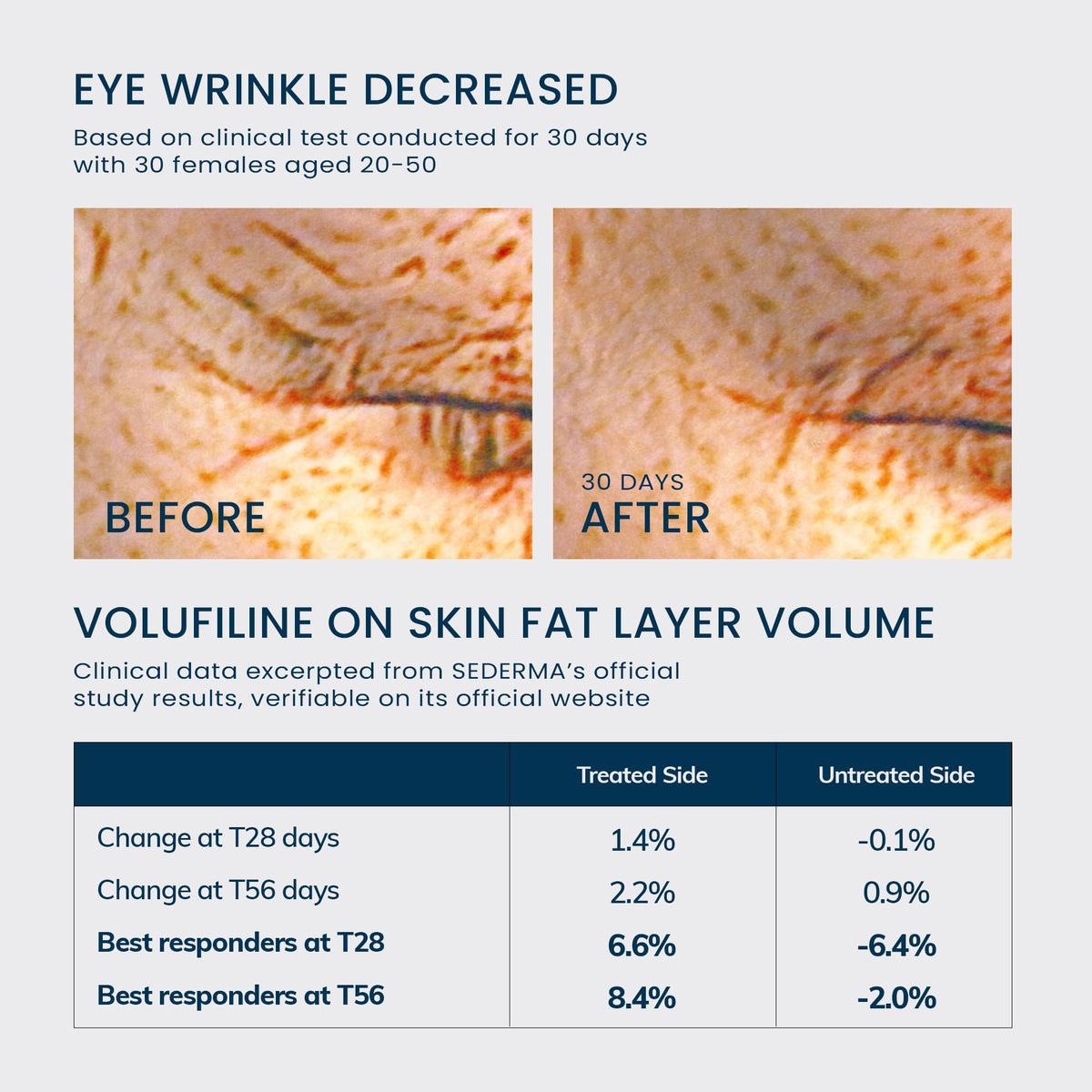 Volume UP Serum NIACINDY Capsule Cream Set for Firm Radiant - mimmua! Official Imagery - 4