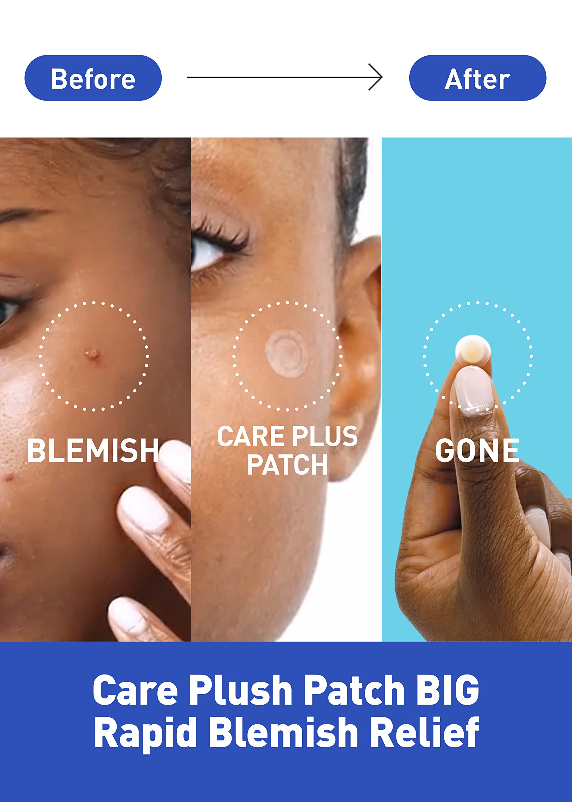 OLIVE YOUNG Care Plus Spot Patch - OLIVE YOUNG
