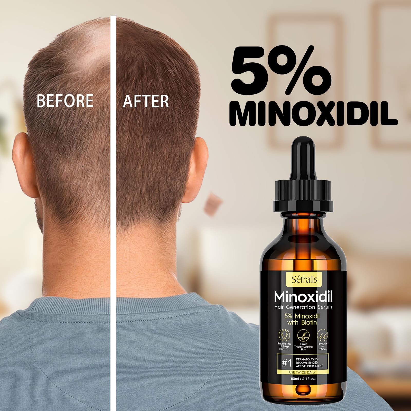 Sefralls 5% Minoxidil Hair Growth Oil - Extra Strength Growth Serum & Topical - Sefralls Official Product View 6
