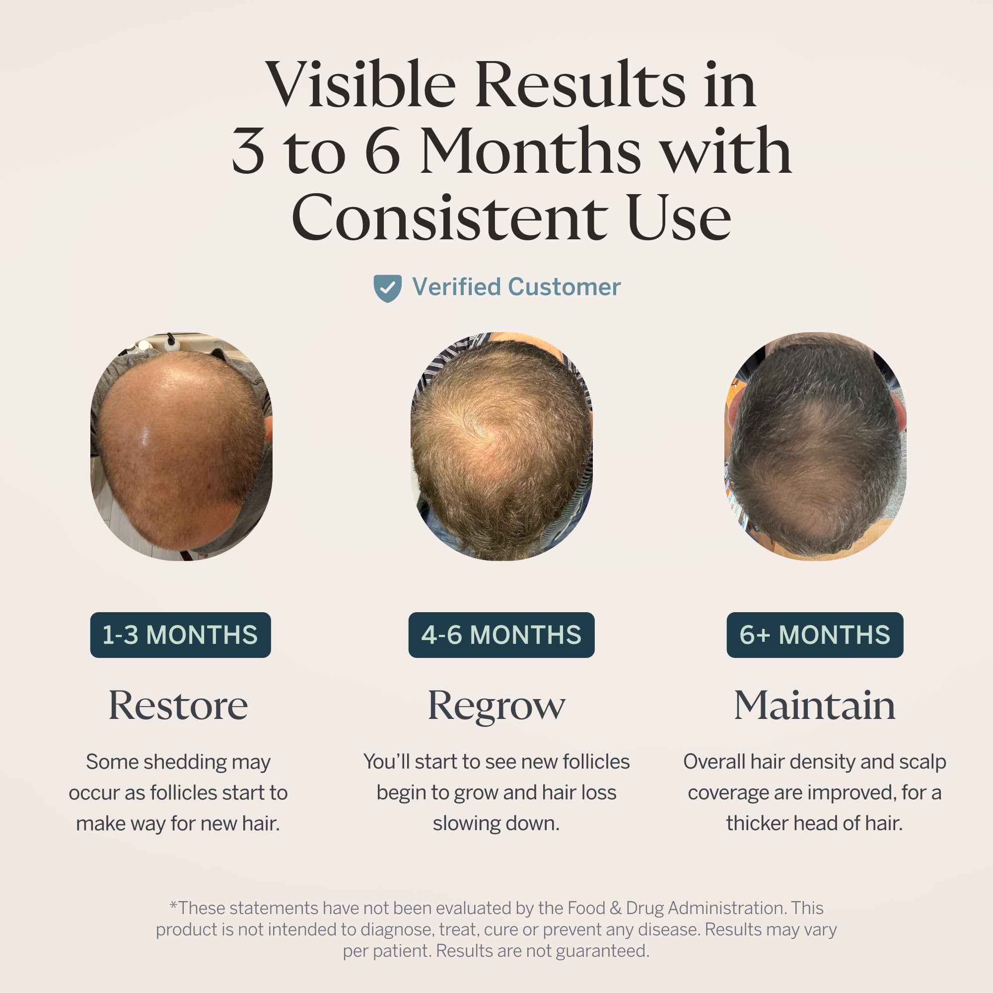 Happy Head Hair Serum for Men Women with Procapil Biotin - Happy Head Official Imagery - 4