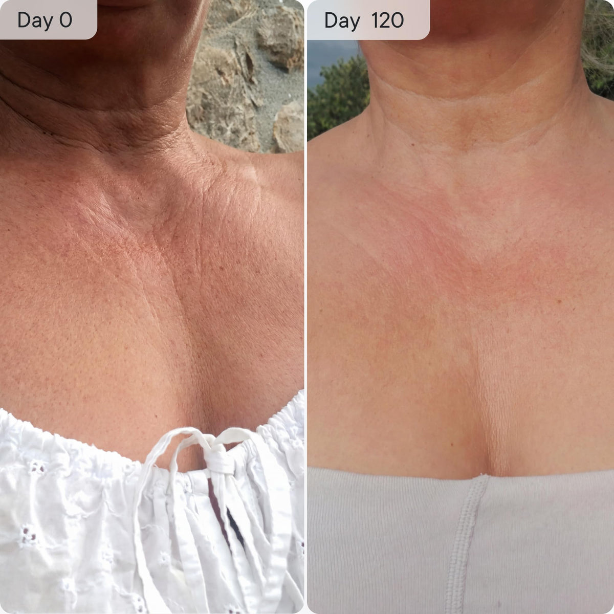 Qure Neck D colletage Chest LED System Red Light Therapy 2 - Qure Official Imagery - 7