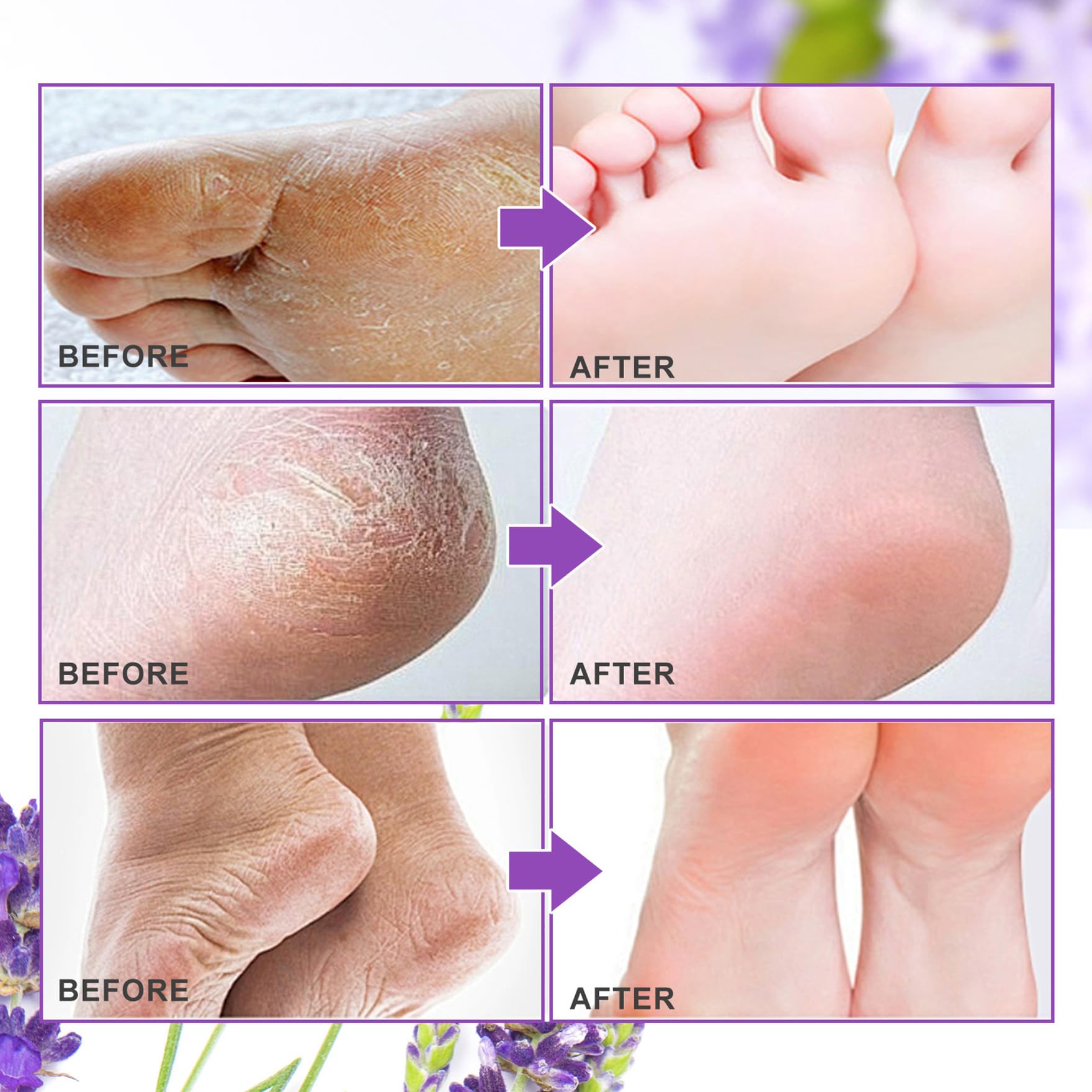 ALIVER Foot Peel Mask 3 Pack, Exfoliator Peel Off Calluses Dead Skin C - View 6