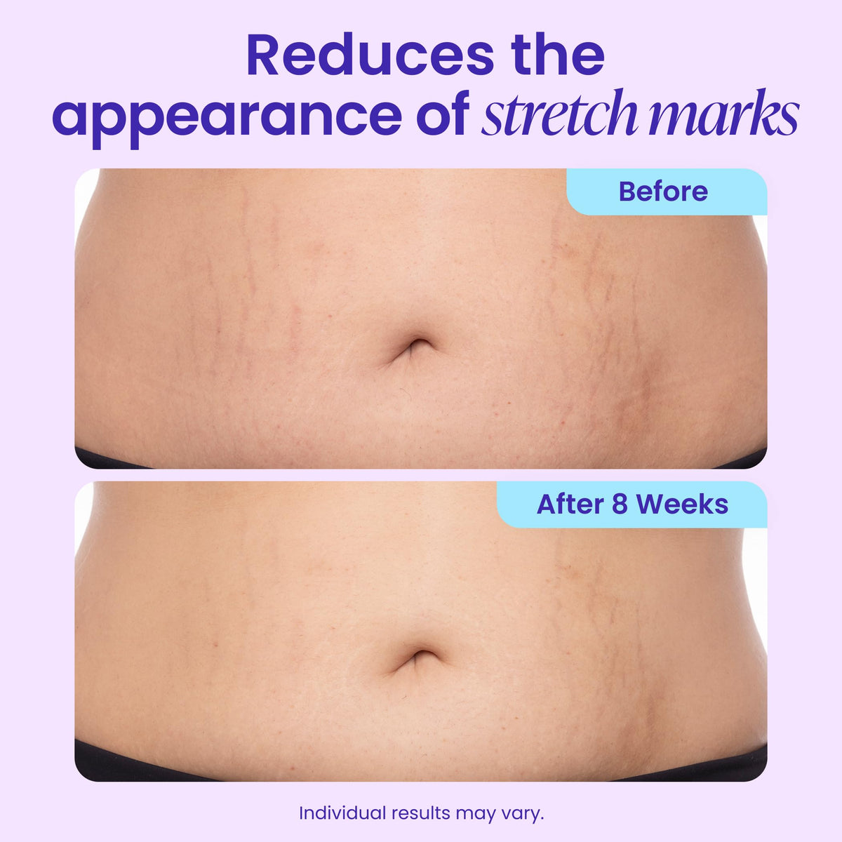 GOPURE Tighten Smooth Belly Cream - goPure Official Imagery - 5