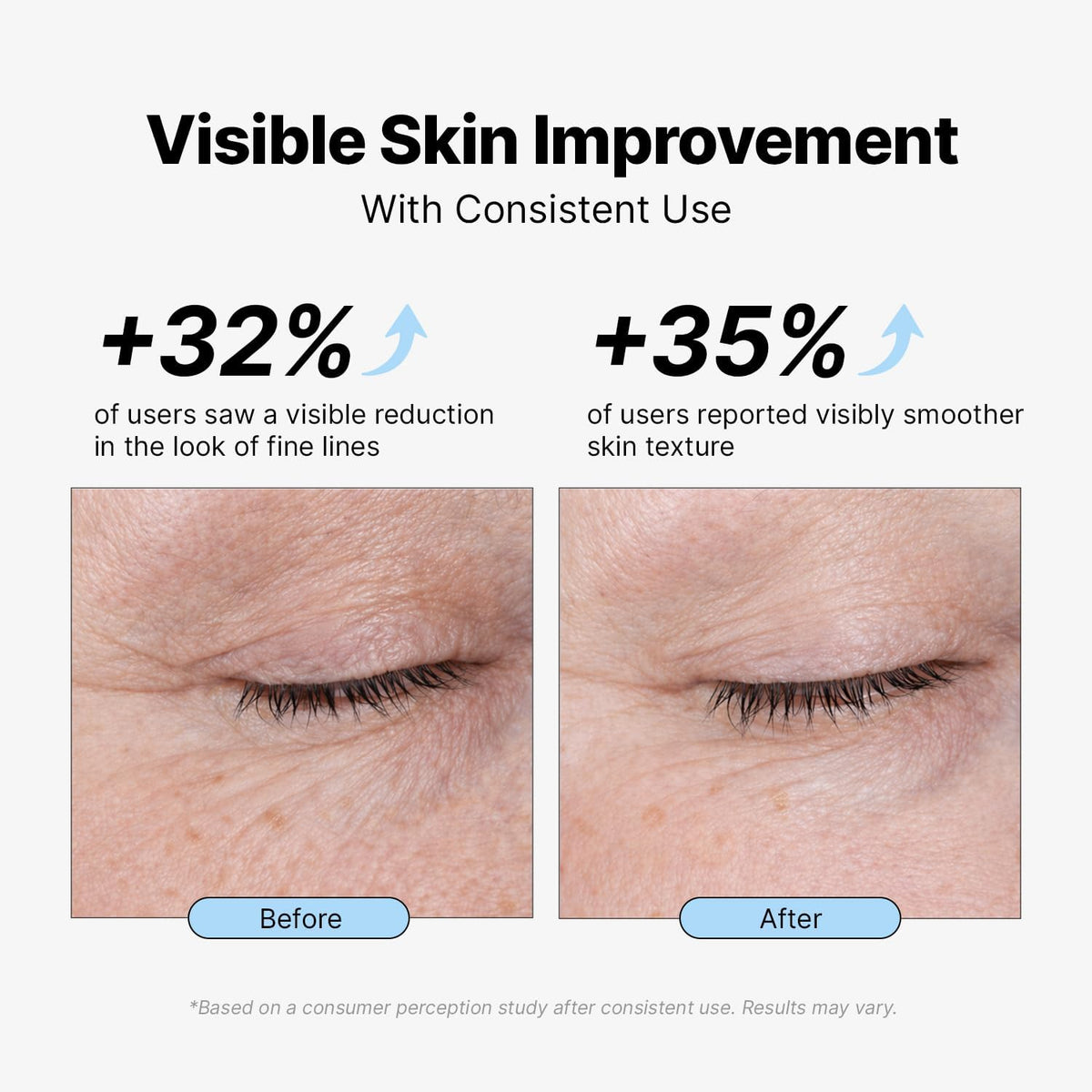 EnaSkin Retinol Collagen Face Cream for Wrinkles Anti Aging - EnaSkin Official Imagery - 5