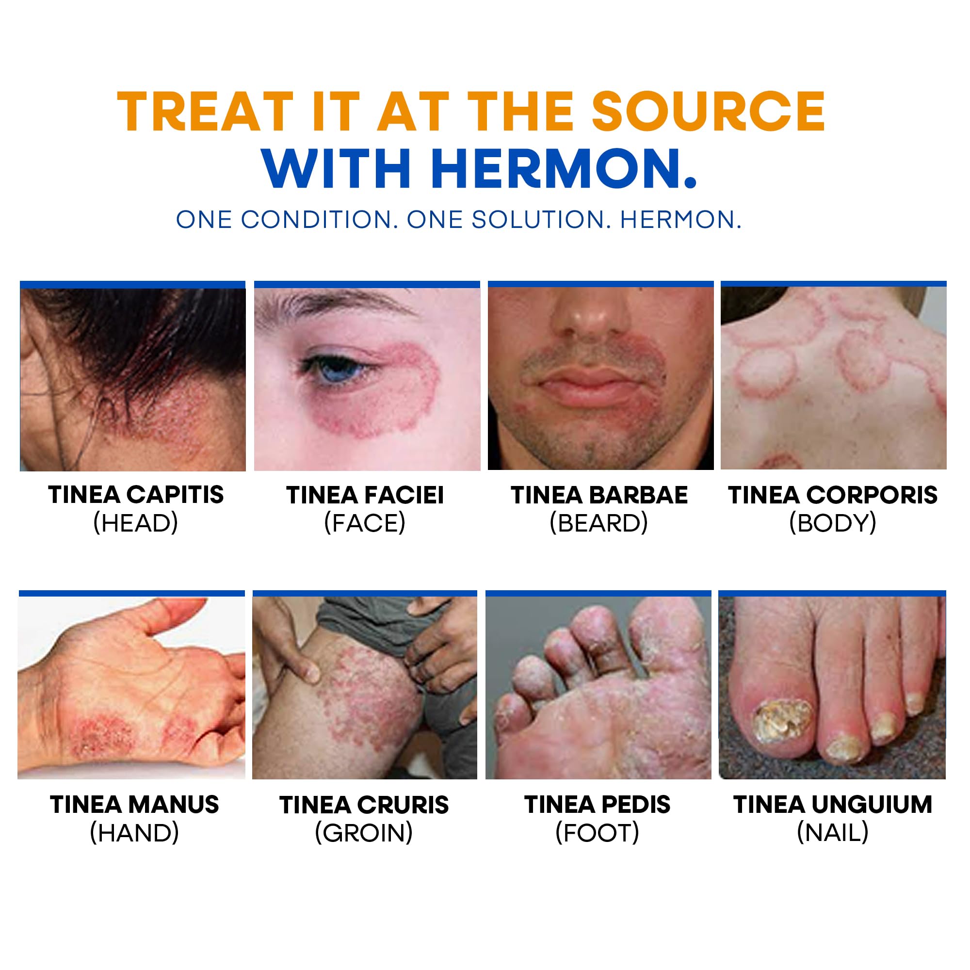 Hermon Antifungal Body Wash 1% Tolnaftate & Tea Tree Oil 500ml