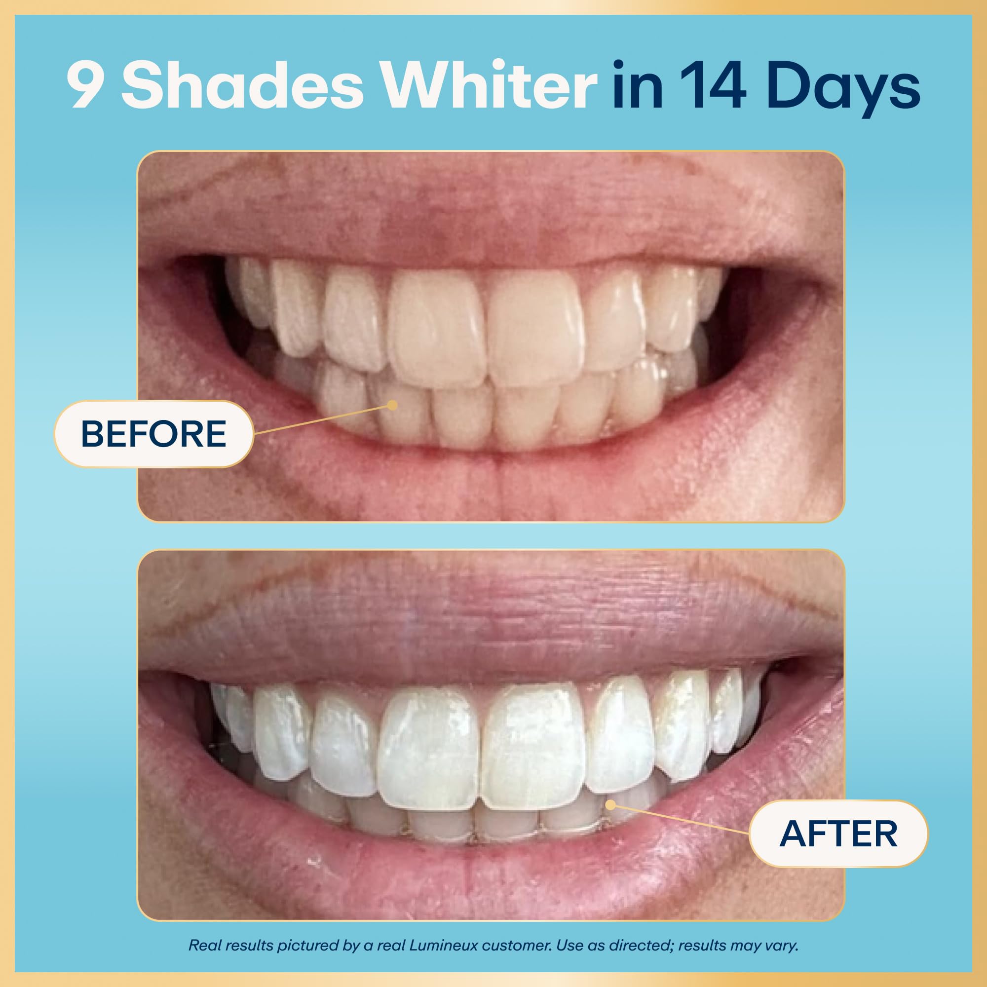 Lumineux Teeth Whitening Strips, Peroxide Free, 9 Treatments (1 Month) - Lumineux Official Product View 2