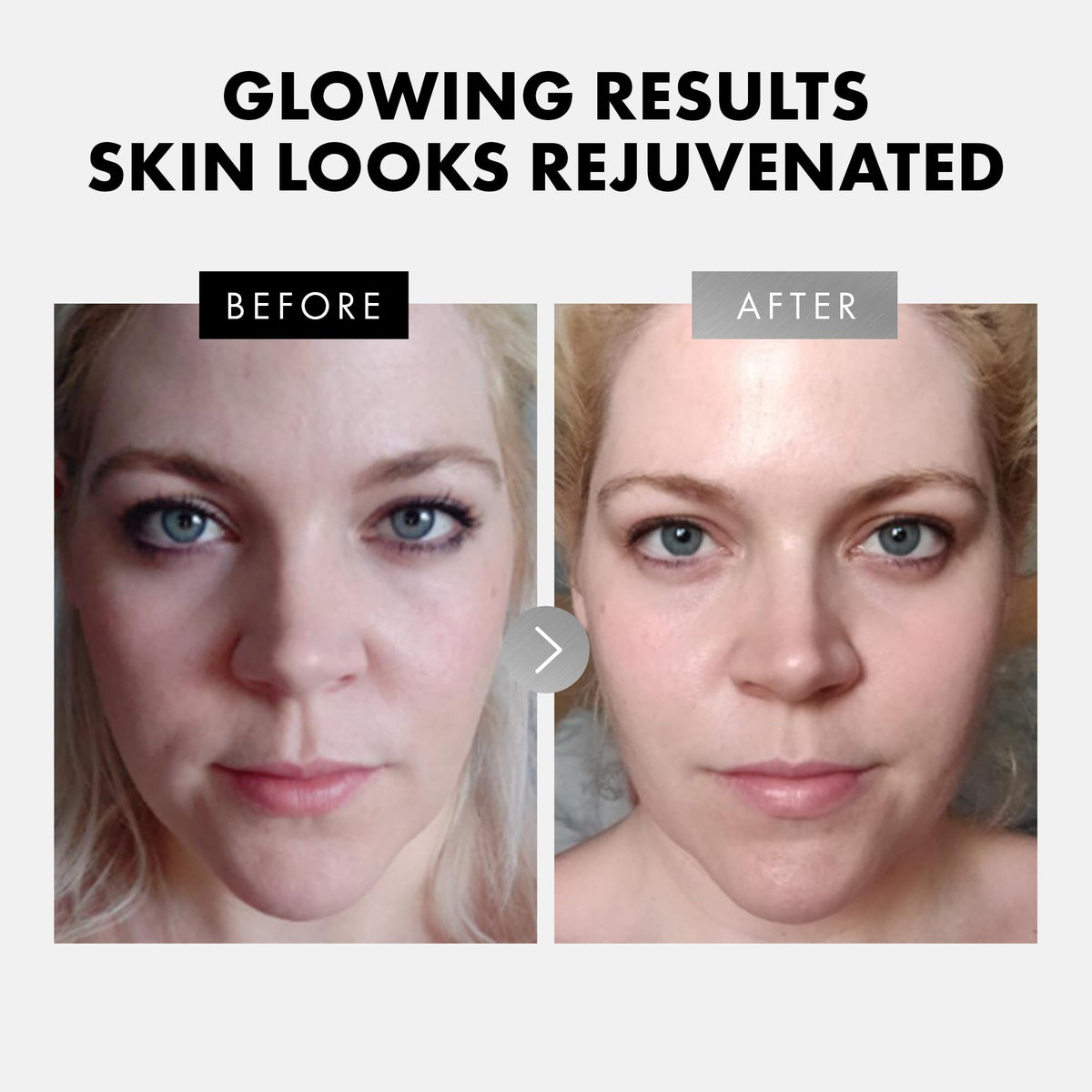 Eclat Skincare Face Serum Set Vitamin C Retinol Serum for - Eclat Skincare Official Imagery - 4