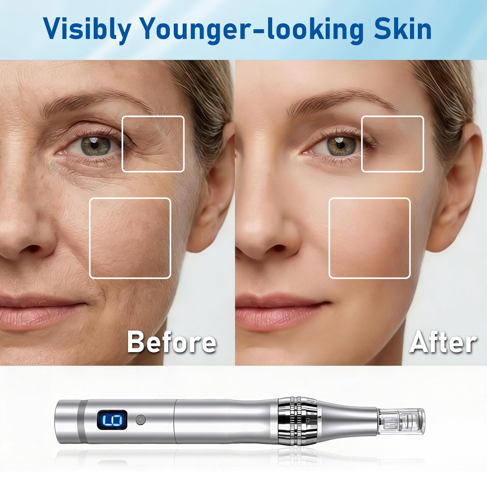 Microneedle Derma Roller Pen for Women Men Skin Home Travel - BEAUTIYAND Official Imagery - 8