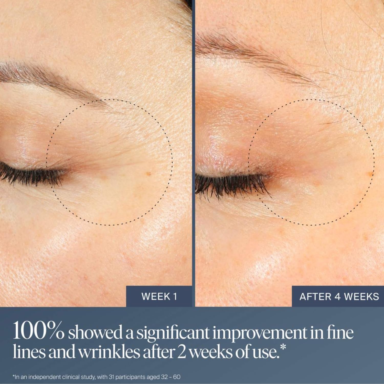 Summer Fridays Jet Lag Overnight Eye Serum - Summer Fridays Official Imagery - 4